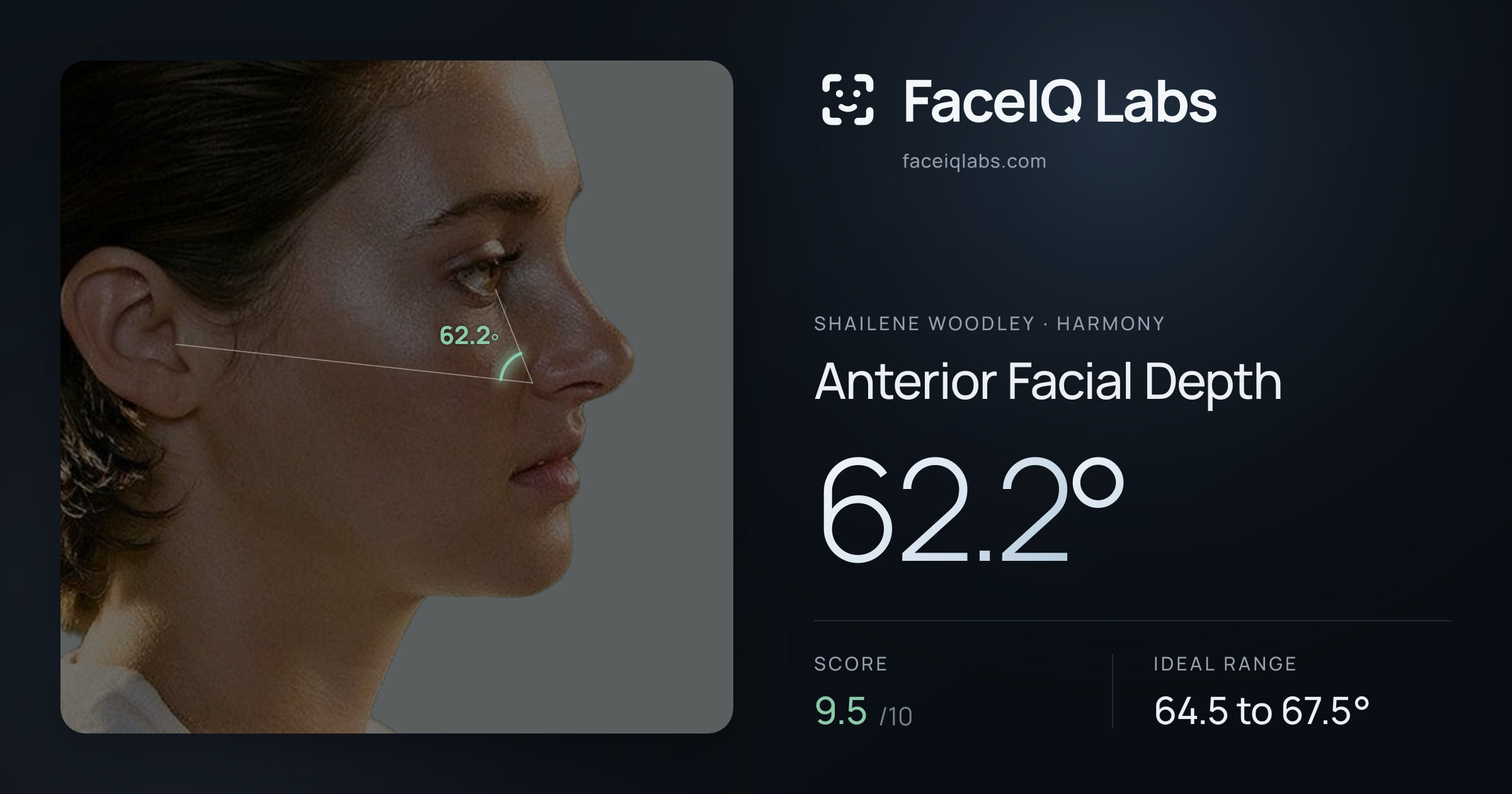 Shailene Woodley Anterior Facial Depth: 62.2°, drawn on the photo