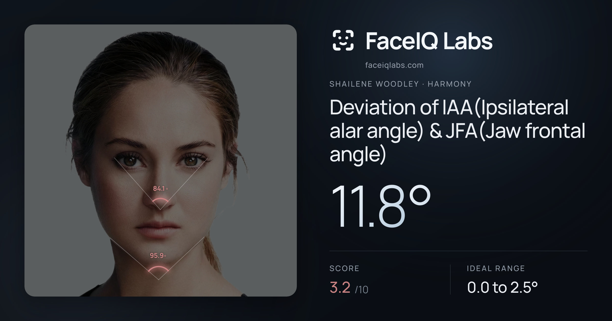 Shailene Woodley Deviation of IAA(Ipsilateral alar angle) & JFA(Jaw frontal angle): 11.8°, drawn on the photo