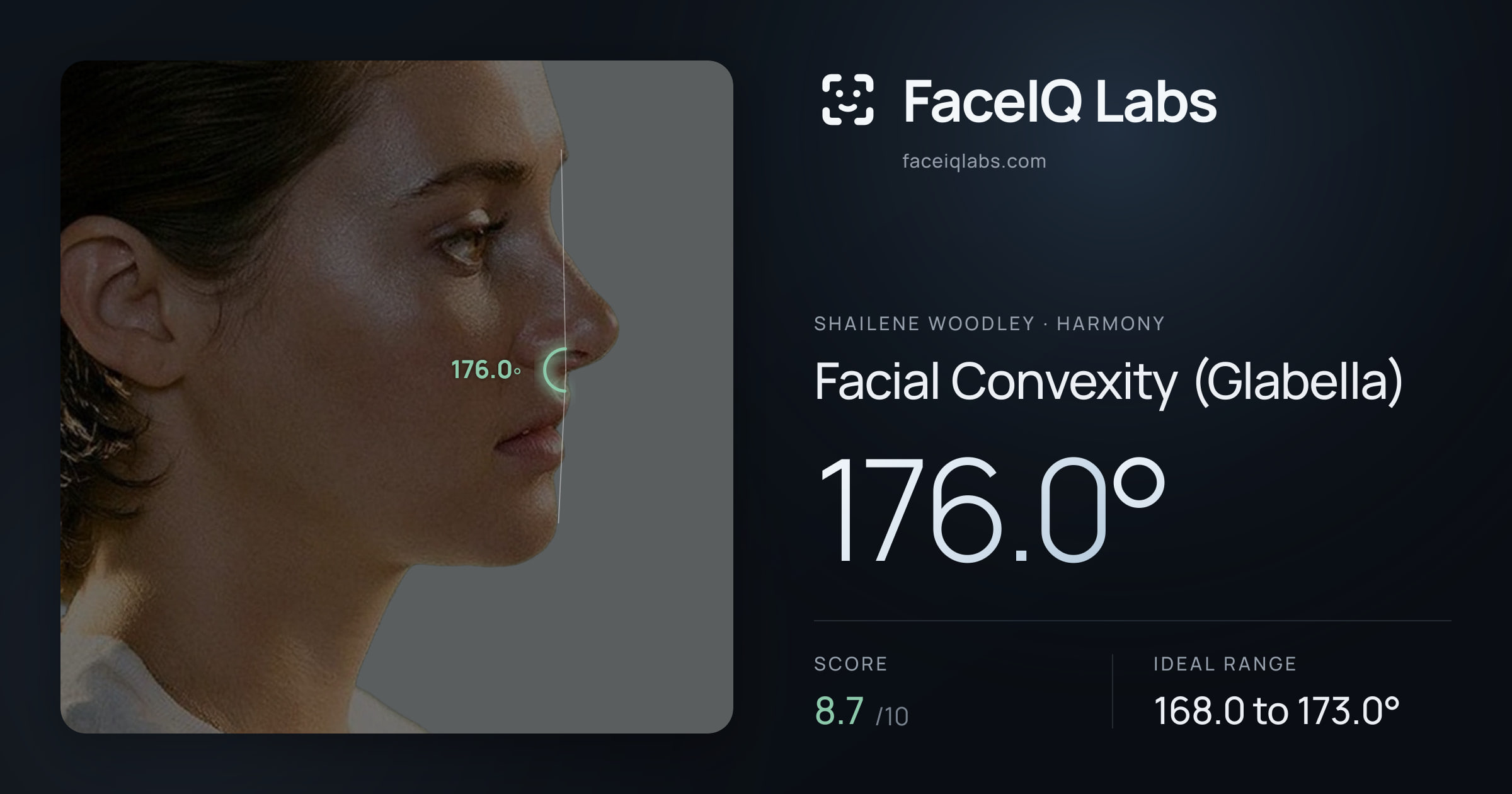 Shailene Woodley Facial Convexity (Glabella): 176.0°, drawn on the photo