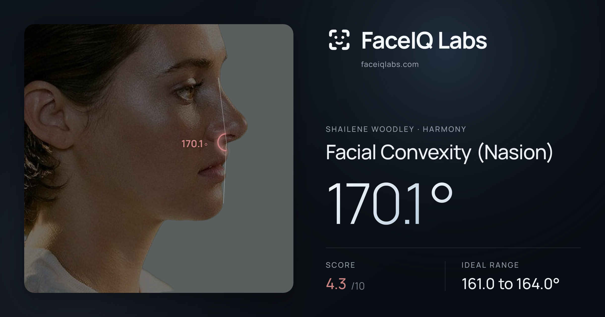 Shailene Woodley Facial Convexity (Nasion): 170.1°, drawn on the photo