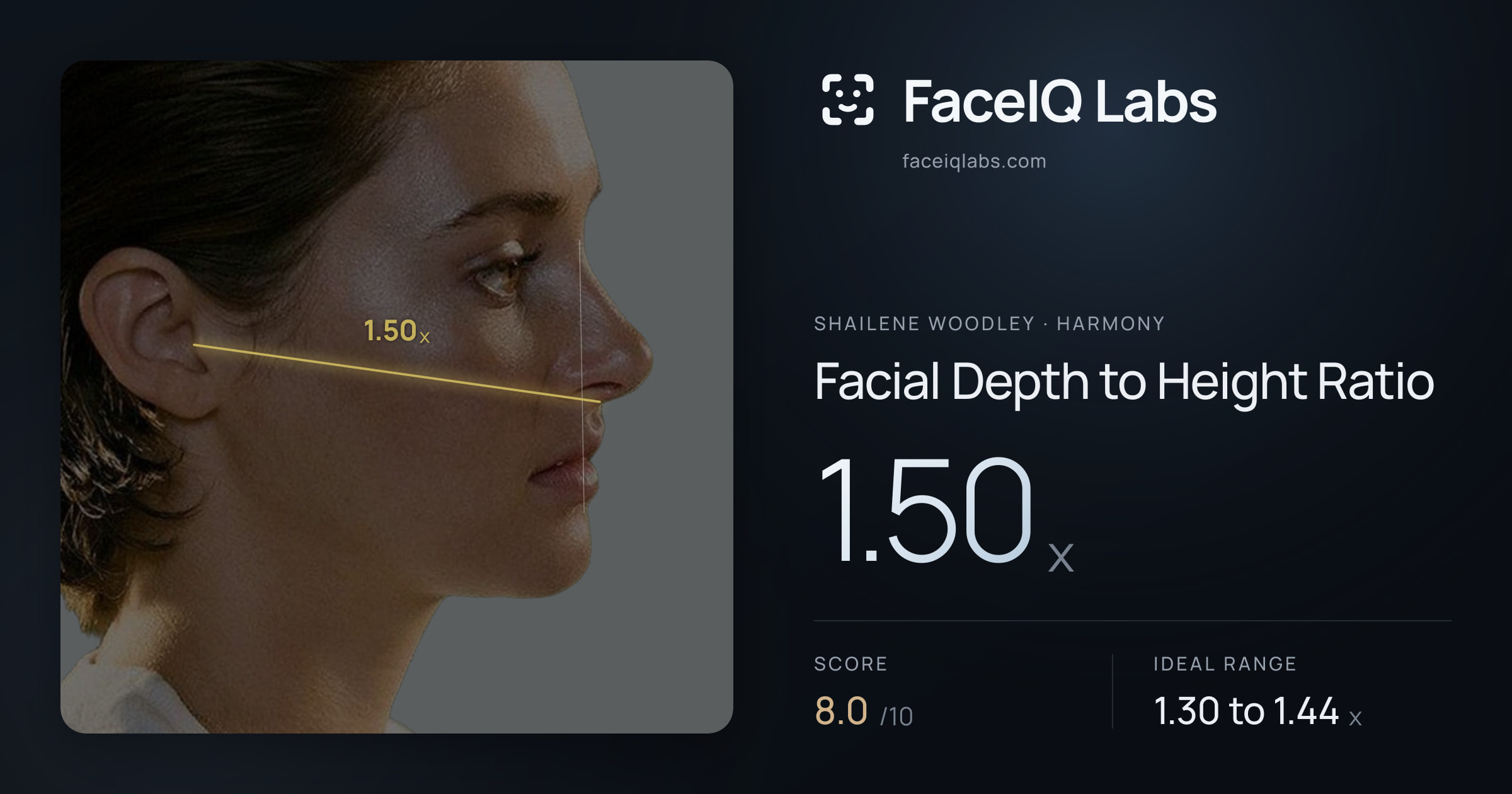 Shailene Woodley Facial Depth to Height Ratio: 1.50x, drawn on the photo