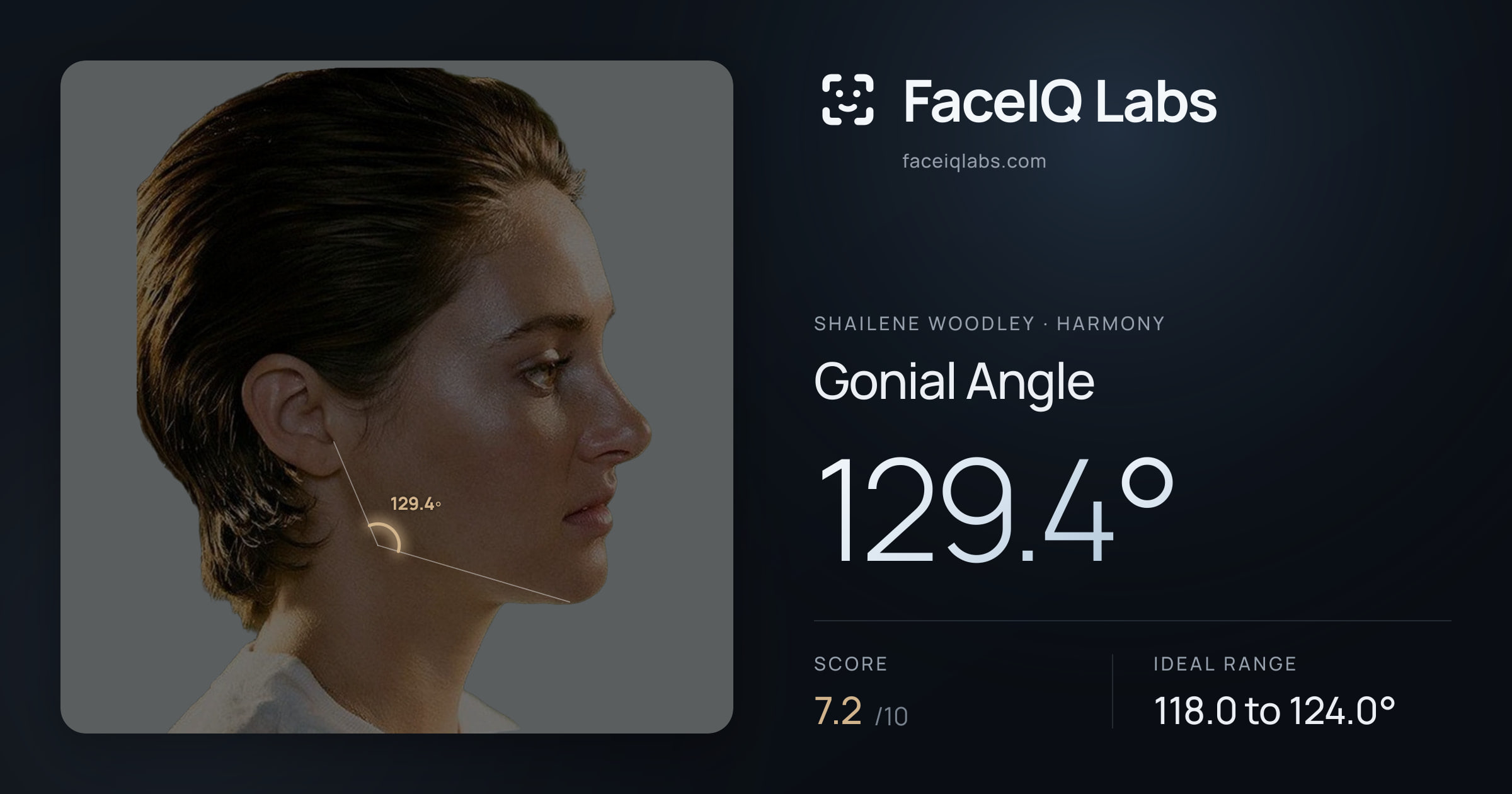 Shailene Woodley Gonial Angle: 129.4°, drawn on the photo