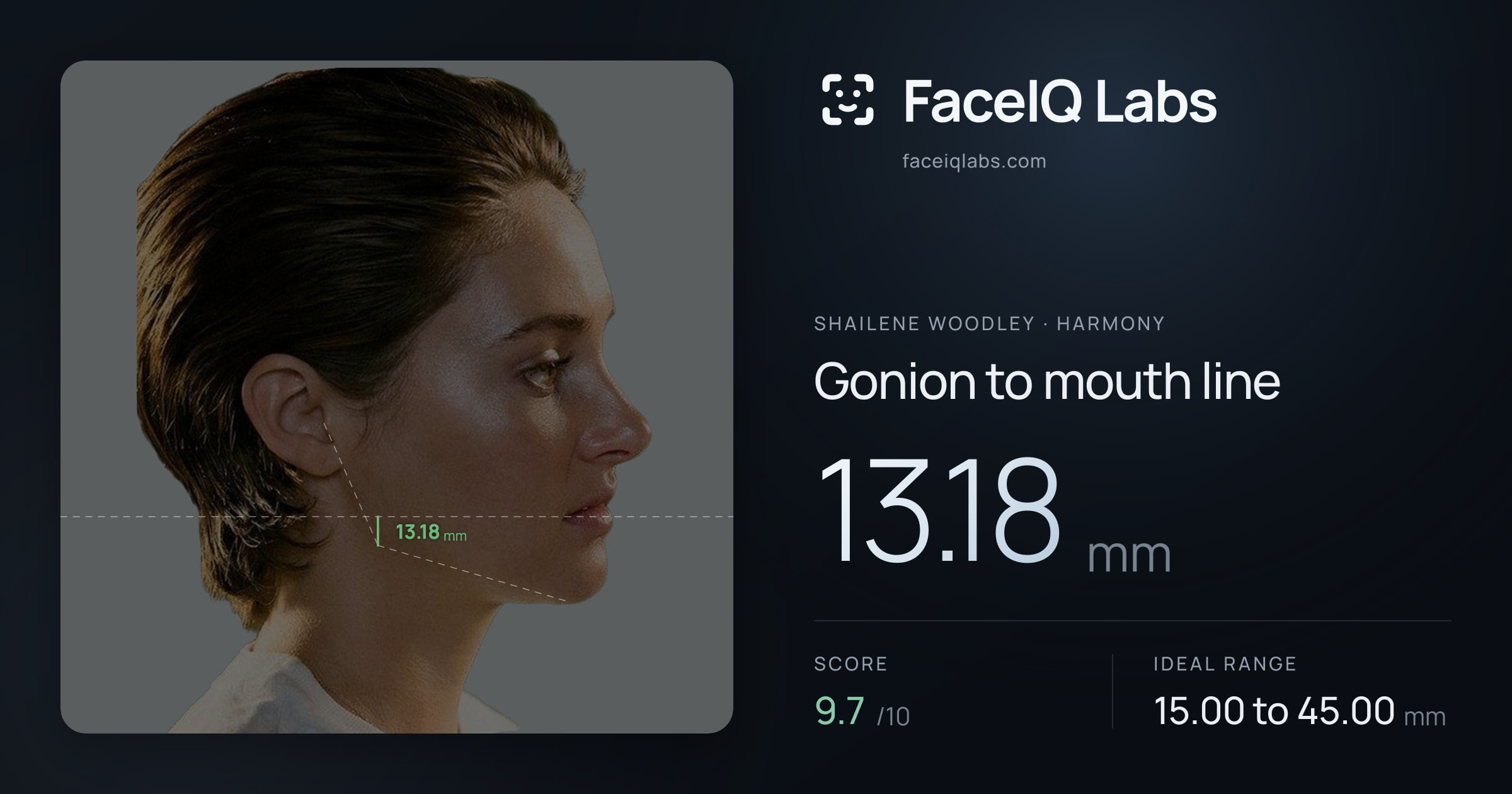 Shailene Woodley Gonion to mouth line: 13.18mm, drawn on the photo