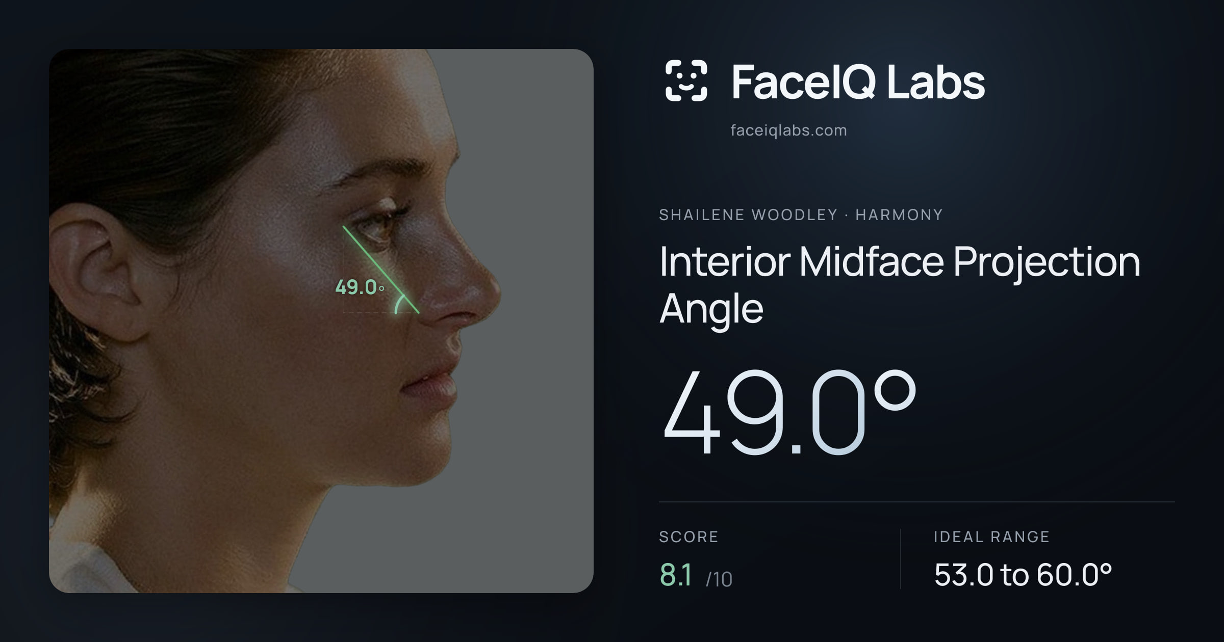 Shailene Woodley Interior Midface Projection Angle: 49.0°, drawn on the photo