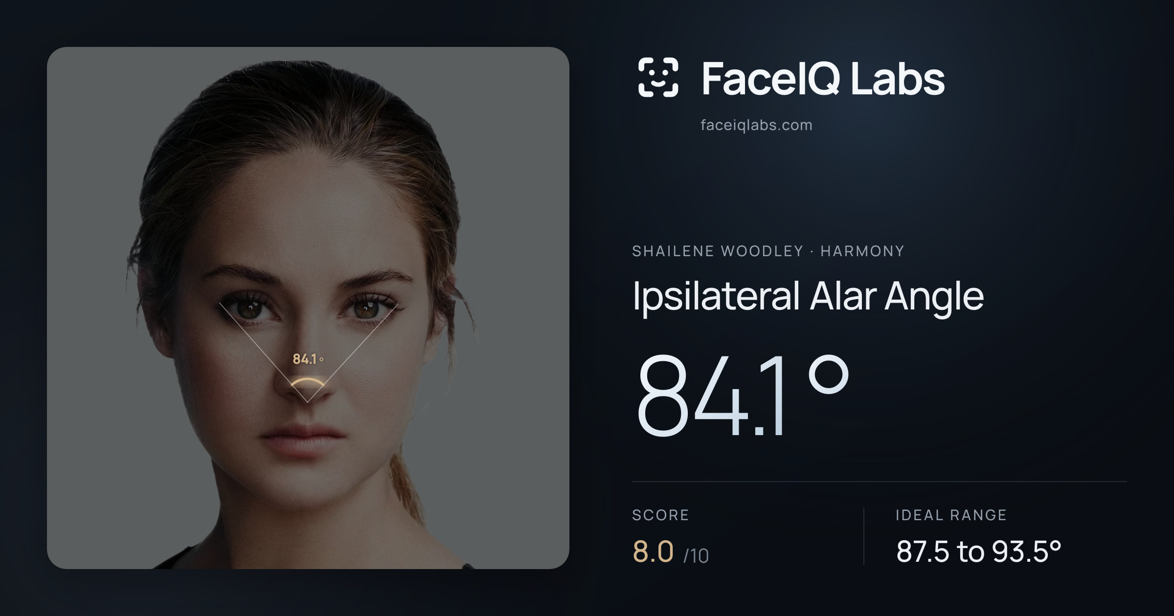 Shailene Woodley Ipsilateral Alar Angle: 84.1°, drawn on the photo