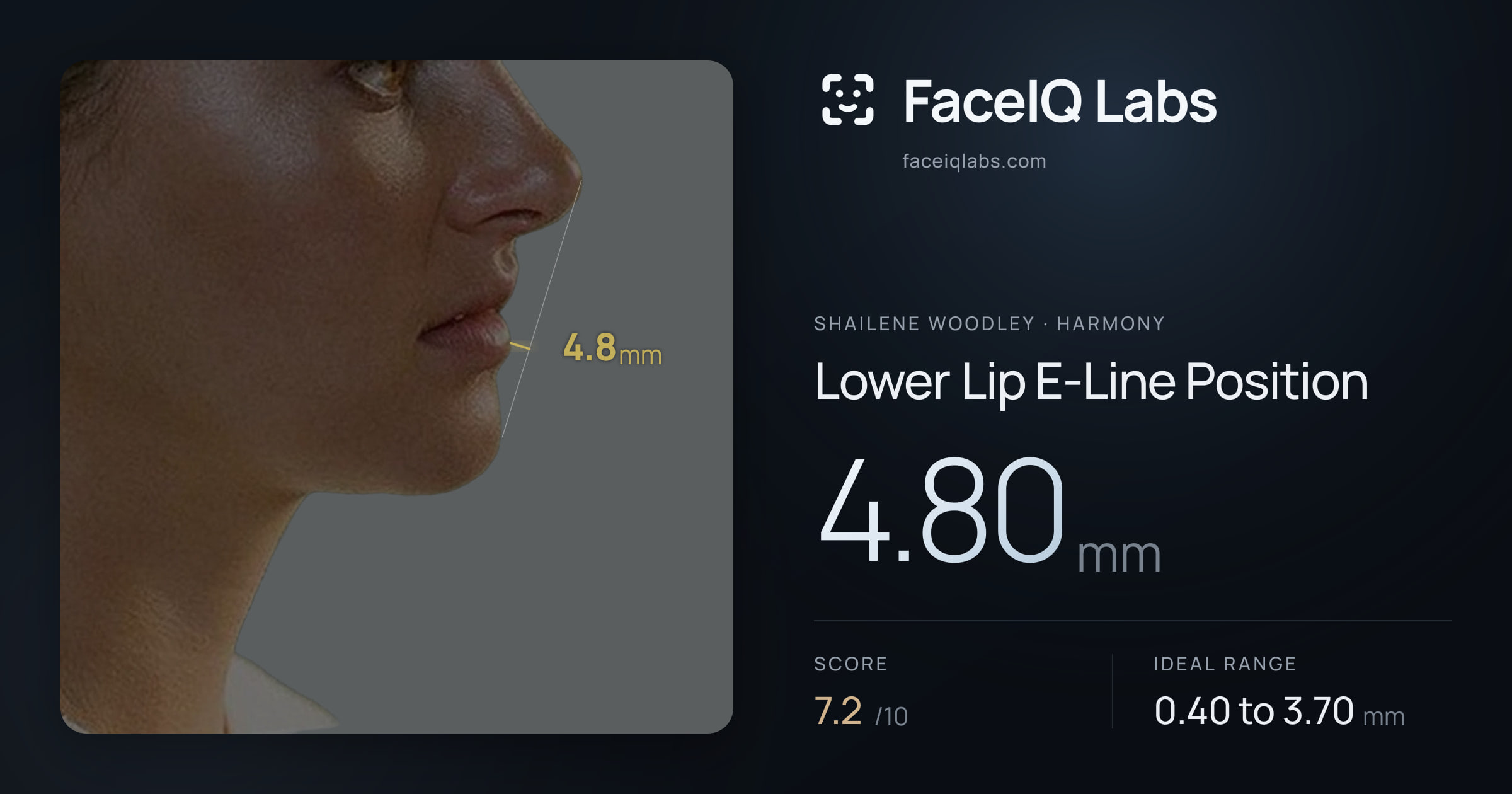 Shailene Woodley Lower Lip E-Line Position: 4.80mm, drawn on the photo