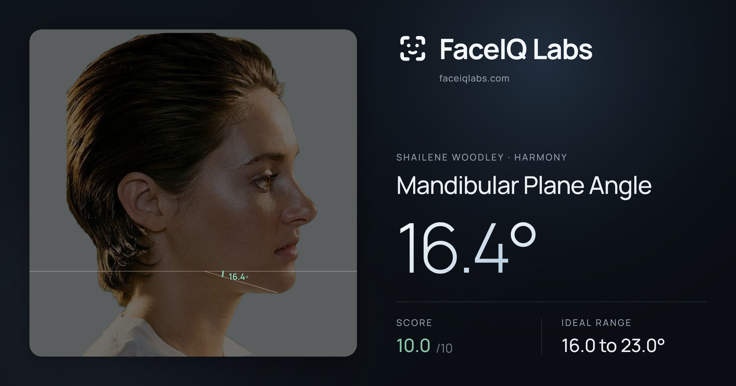 Shailene Woodley Mandibular Plane Angle: 16.4°, drawn on the photo