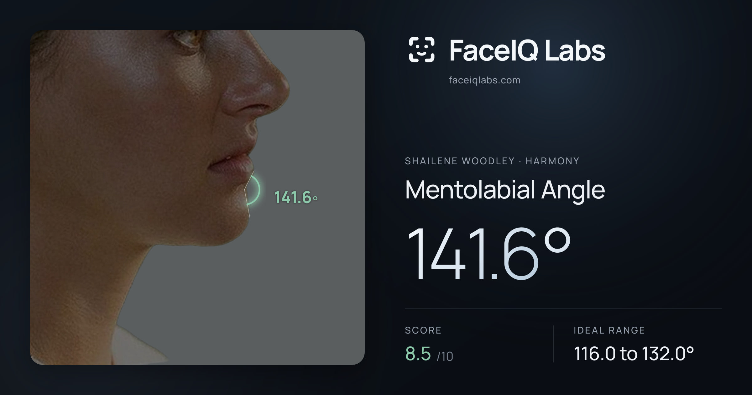 Shailene Woodley Mentolabial Angle: 141.6°, drawn on the photo