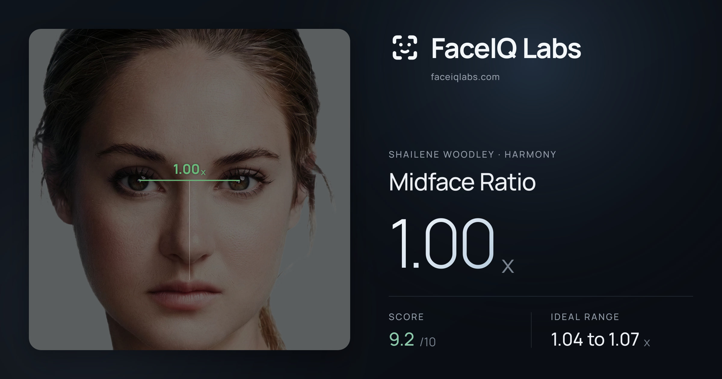 Shailene Woodley Midface Ratio: 1.00x, drawn on the photo