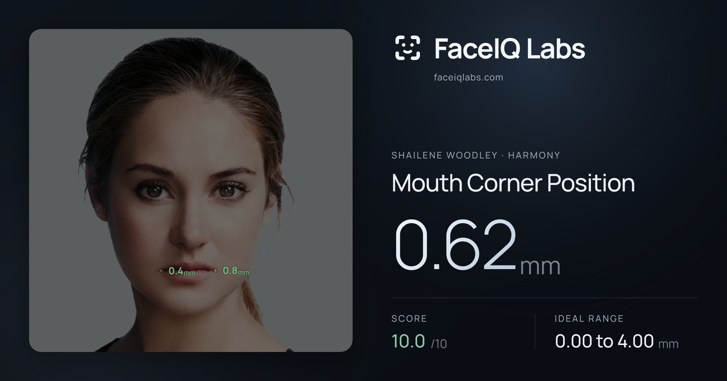 Shailene Woodley Mouth Corner Position: 0.62mm, drawn on the photo