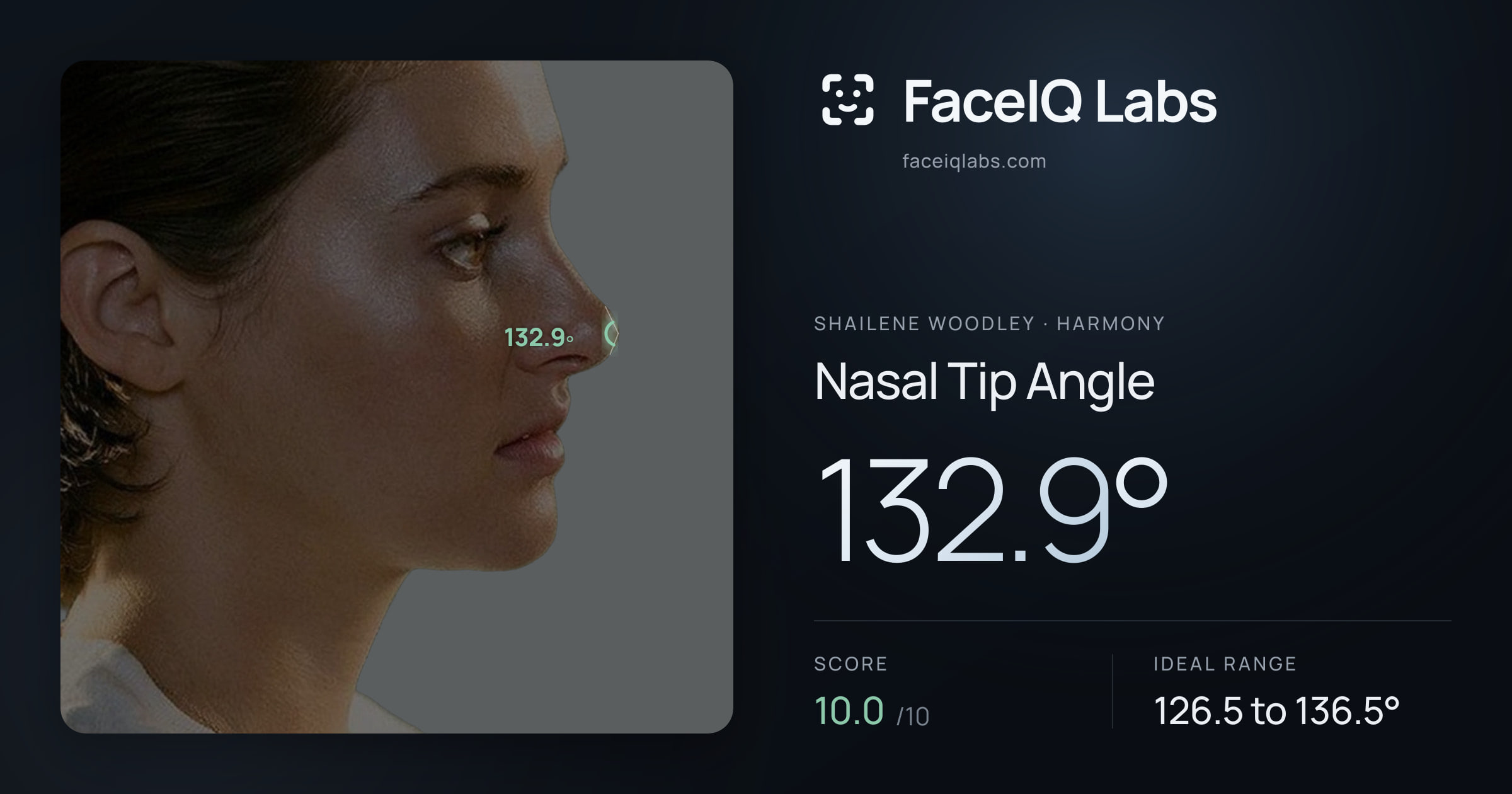 Shailene Woodley Nasal Tip Angle: 132.9°, drawn on the photo