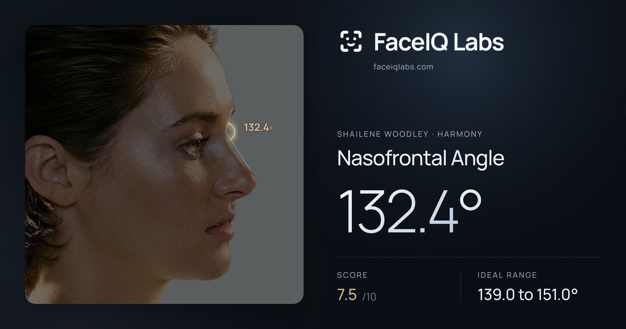 Shailene Woodley Nasofrontal Angle: 132.4°, drawn on the photo