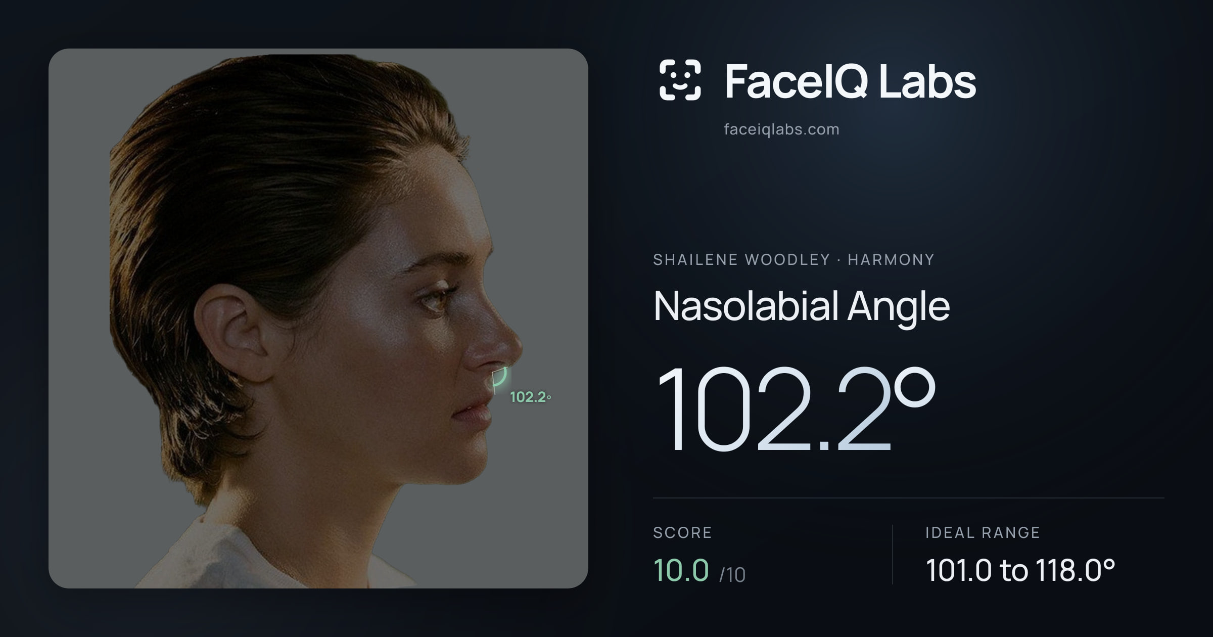 Shailene Woodley Nasolabial Angle: 102.2°, drawn on the photo