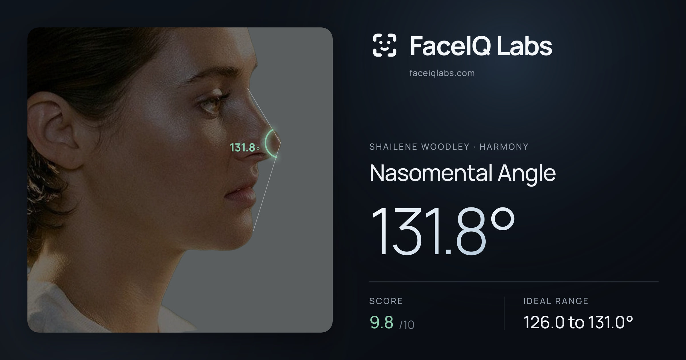 Shailene Woodley Nasomental Angle: 131.8°, drawn on the photo