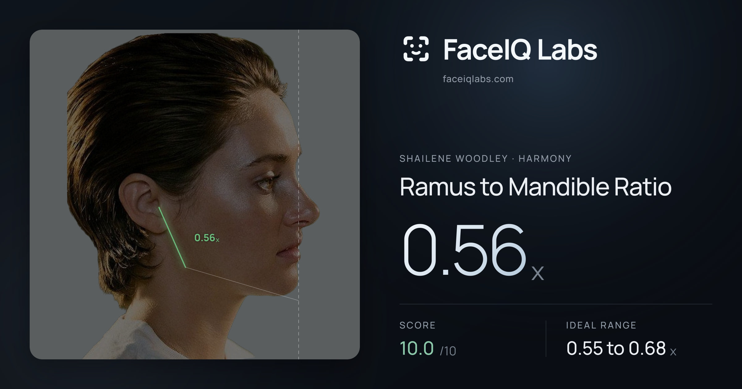 Shailene Woodley Ramus to Mandible Ratio: 0.56x, drawn on the photo