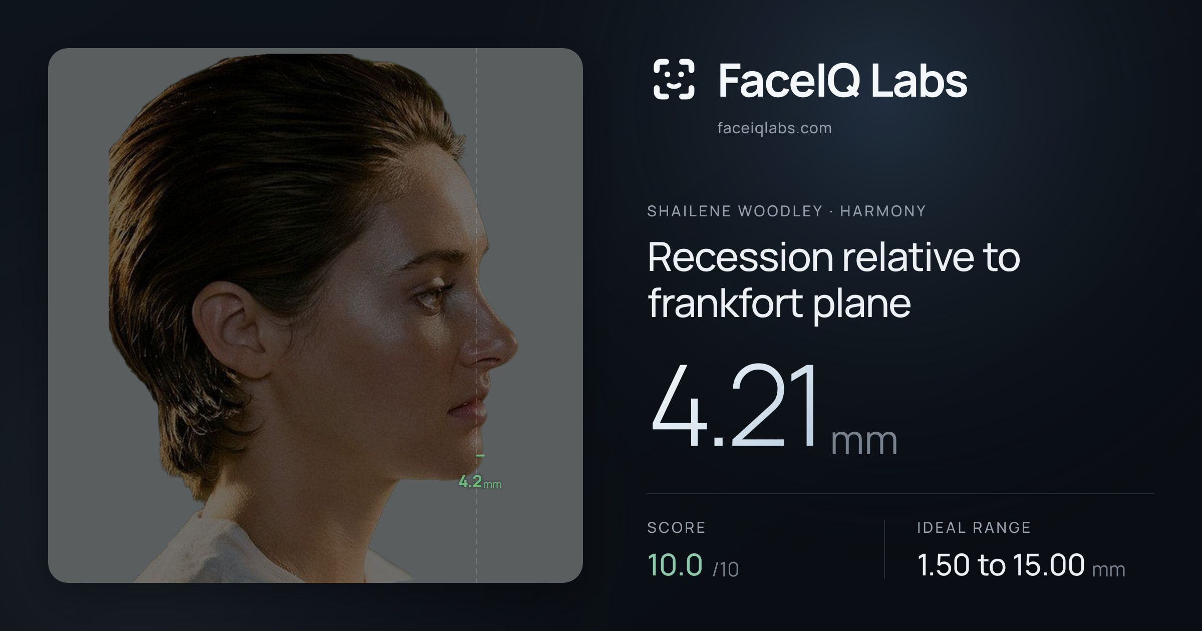 Shailene Woodley Recession relative to frankfort plane: 4.21mm, drawn on the photo