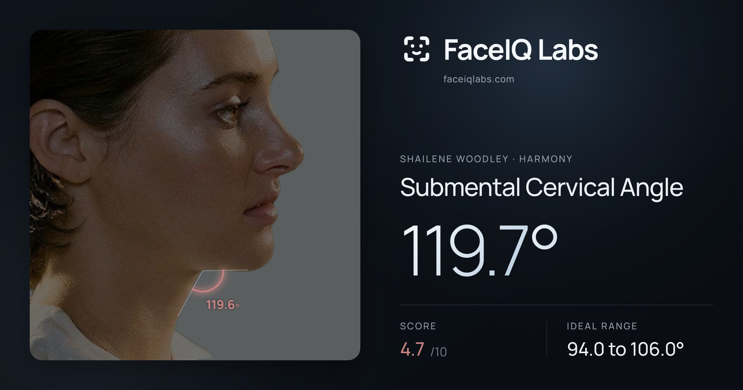 Shailene Woodley Submental Cervical Angle: 119.7°, drawn on the photo