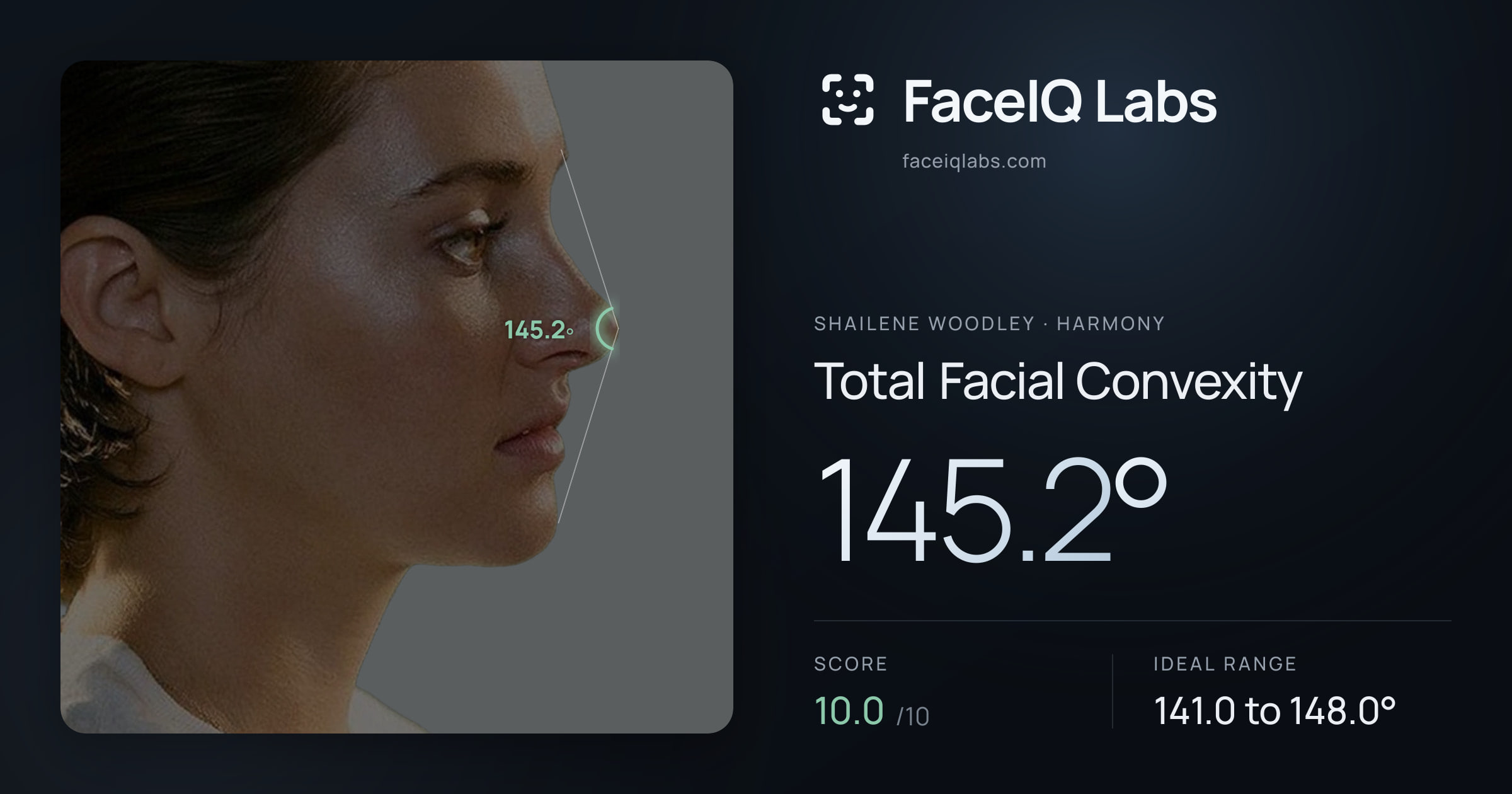Shailene Woodley Total Facial Convexity: 145.2°, drawn on the photo
