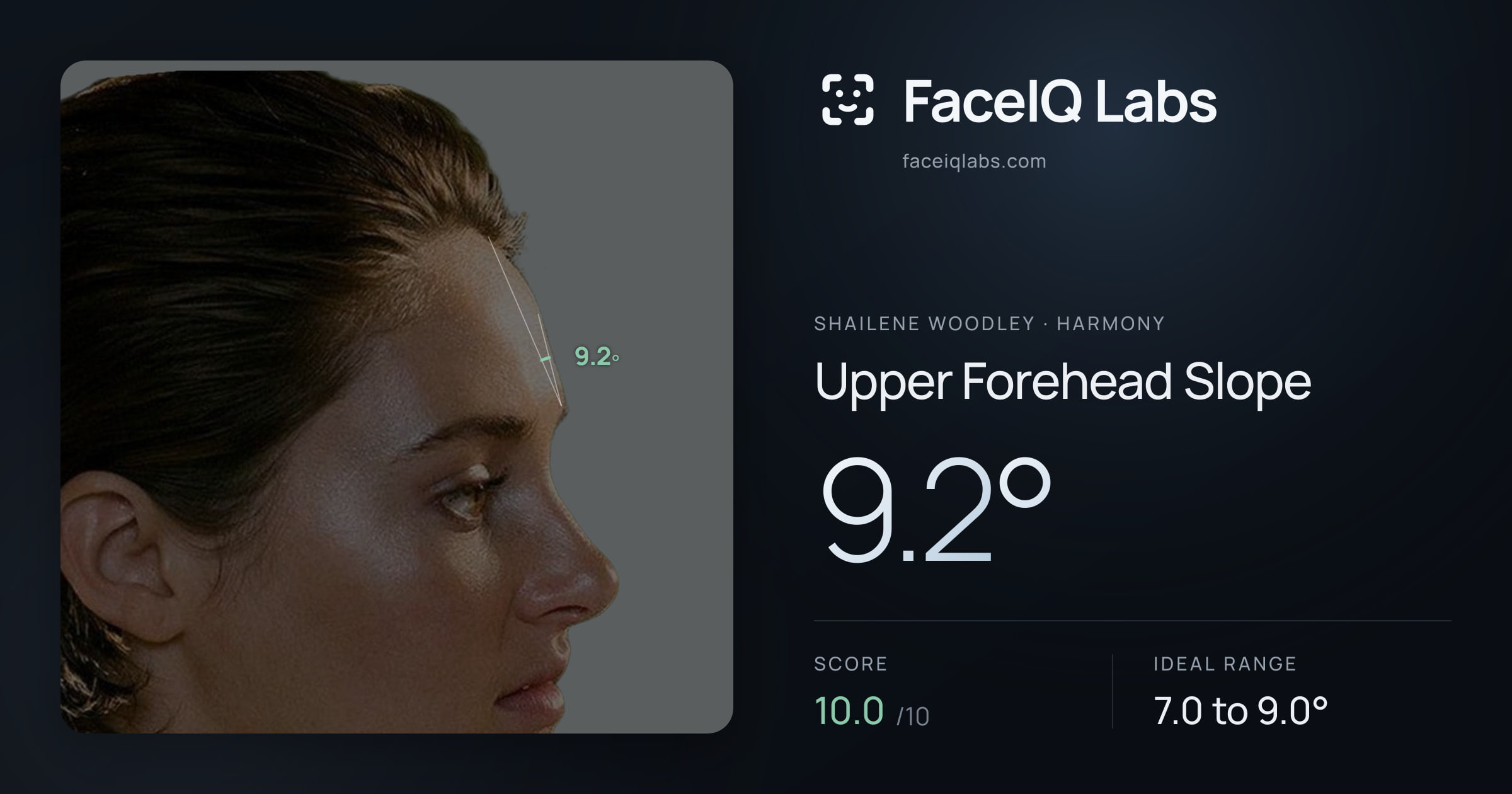 Shailene Woodley Upper Forehead Slope: 9.2°, drawn on the photo