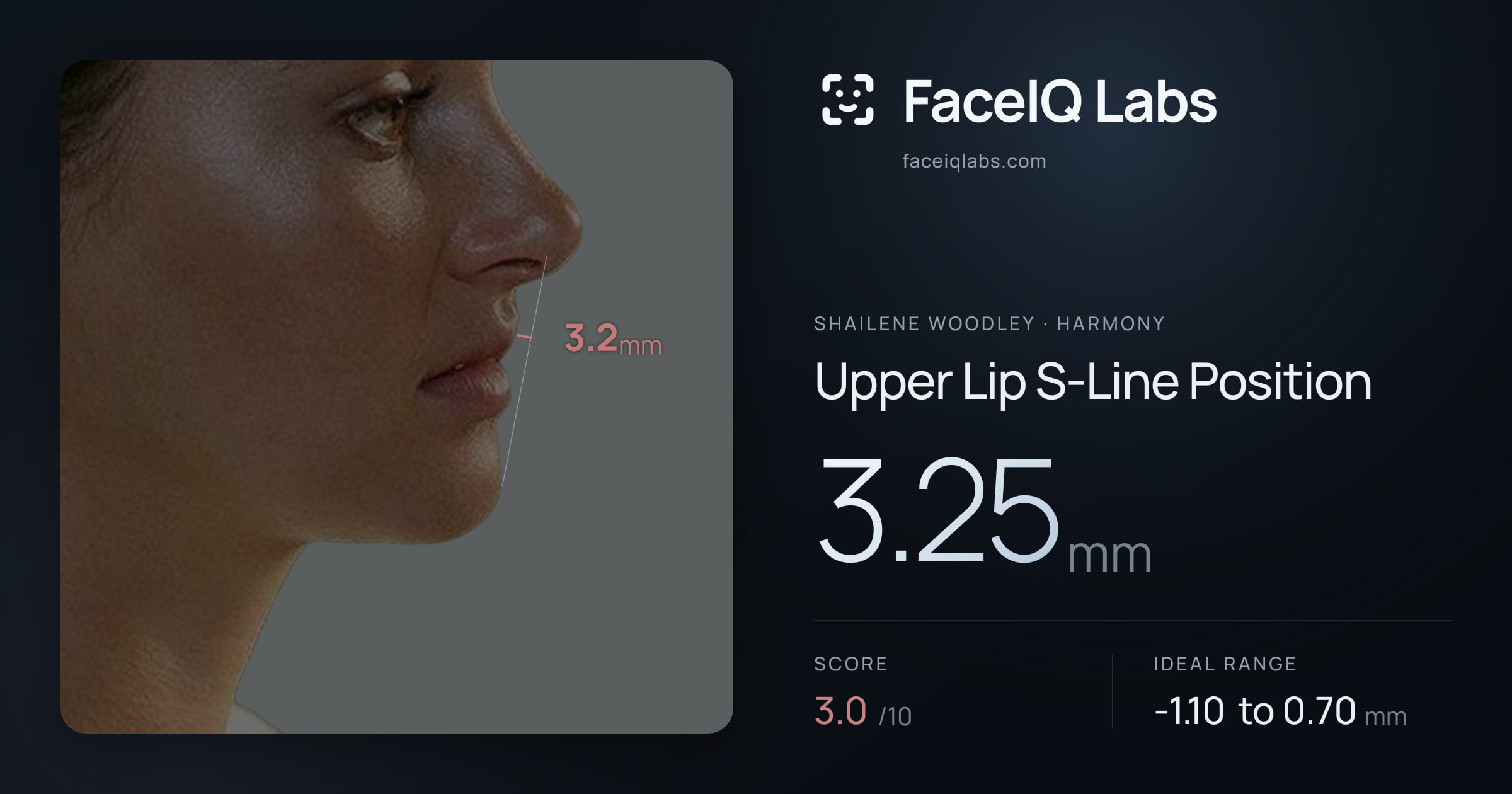 Shailene Woodley Upper Lip S-Line Position: 3.25mm, drawn on the photo