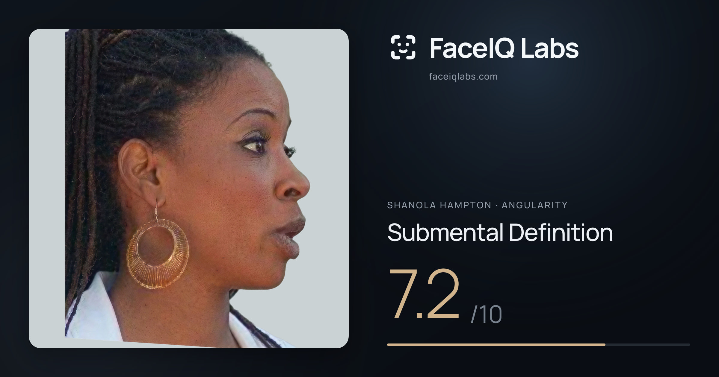 Shanola Hampton Submental Definition: 7.2/10, drawn on the photo