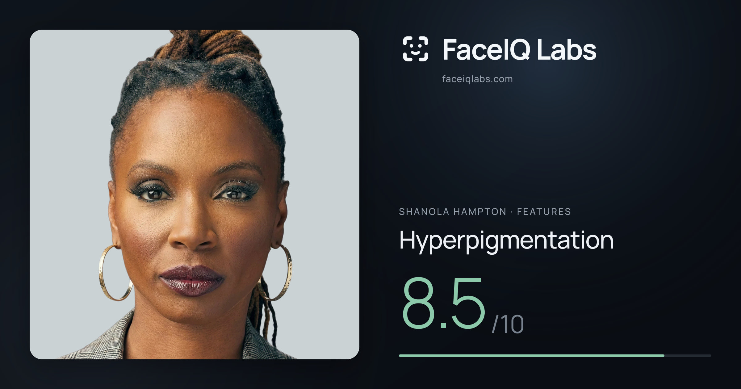 Shanola Hampton Hyperpigmentation: 8.5/10, drawn on the photo
