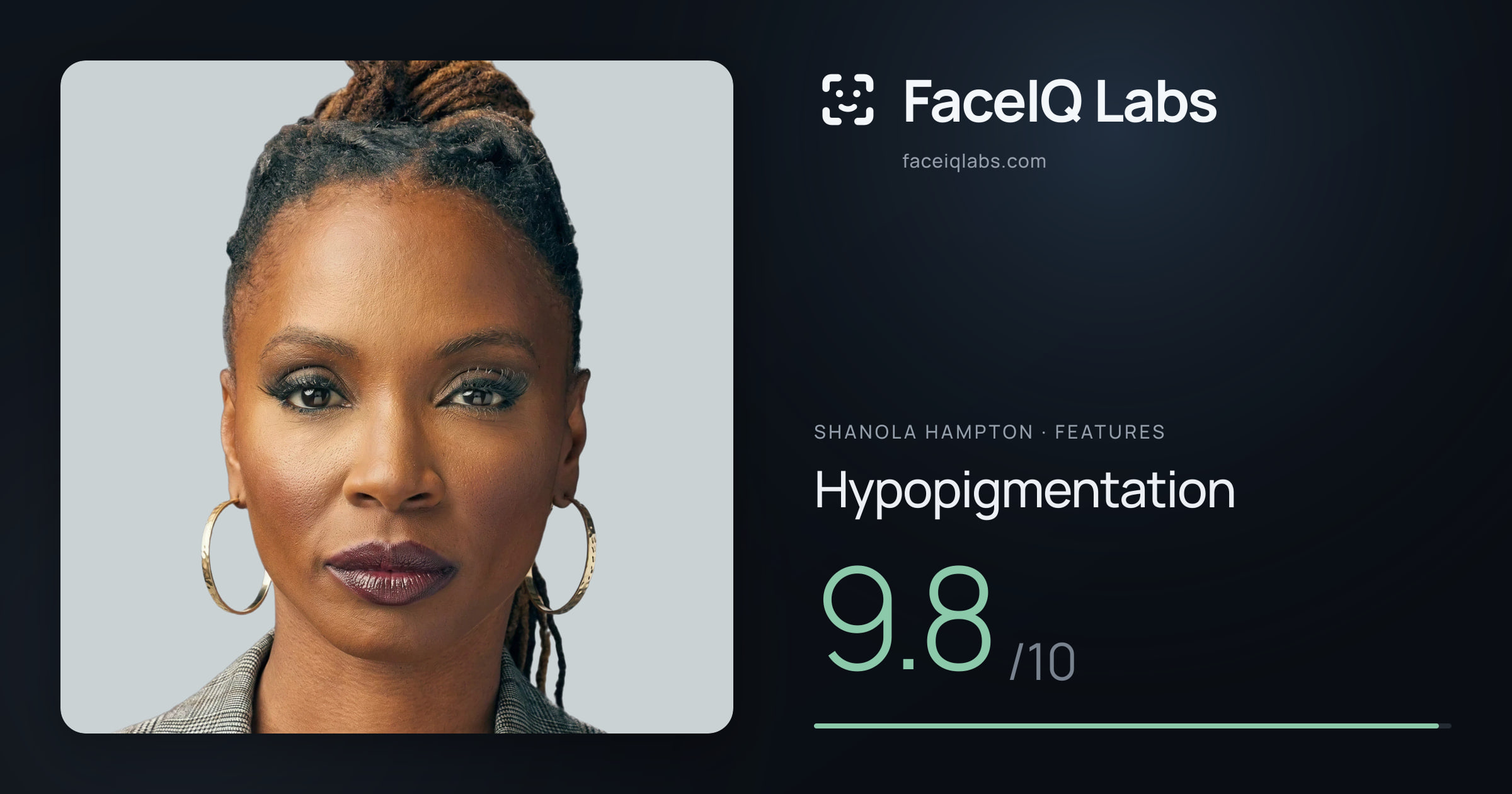 Shanola Hampton Hypopigmentation: 9.8/10, drawn on the photo