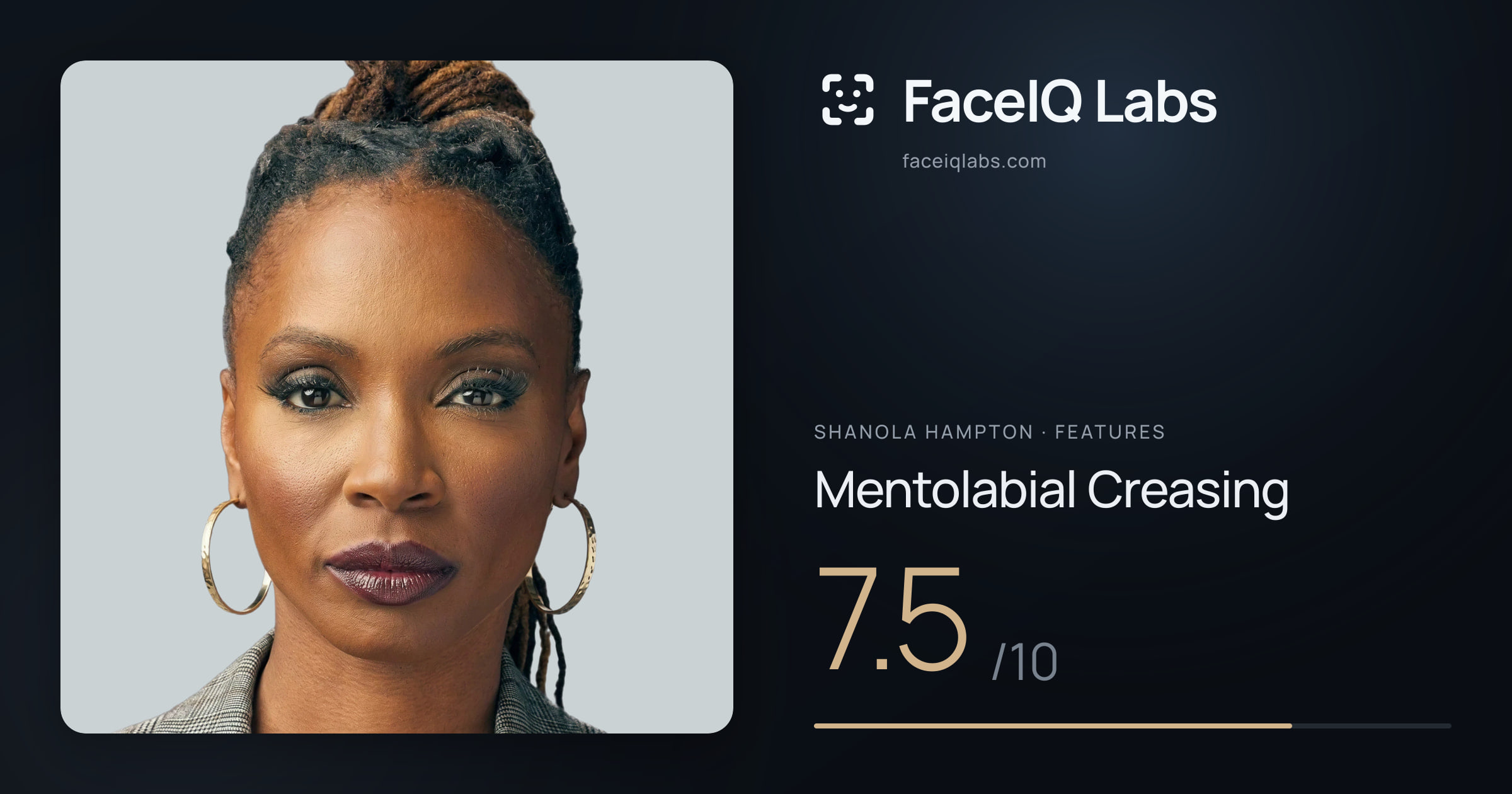 Shanola Hampton Mentolabial Creasing: 7.5/10, drawn on the photo