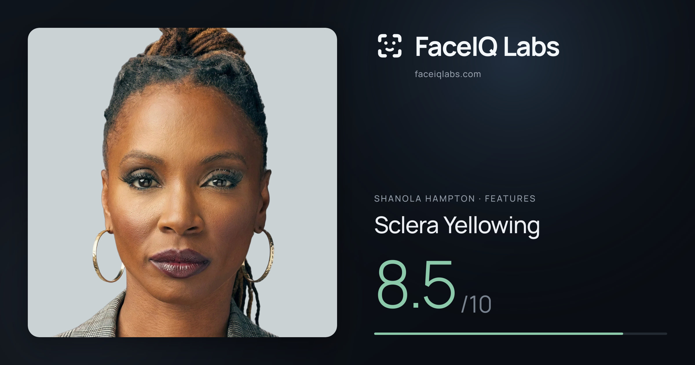 Shanola Hampton Sclera Yellowing: 8.5/10, drawn on the photo