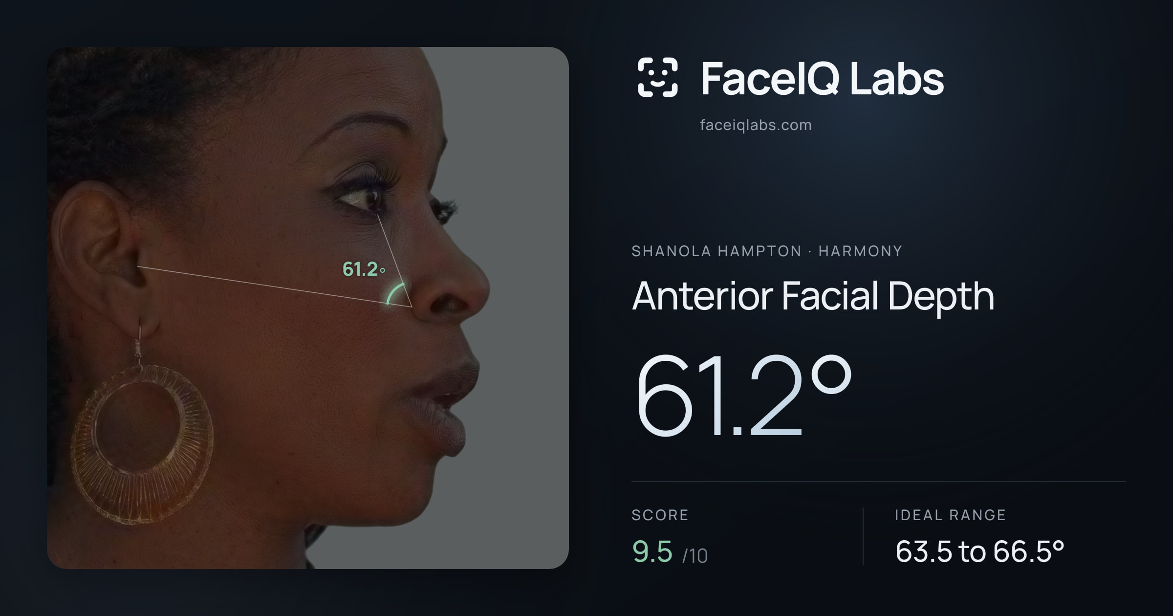 Shanola Hampton Anterior Facial Depth: 61.2°, drawn on the photo