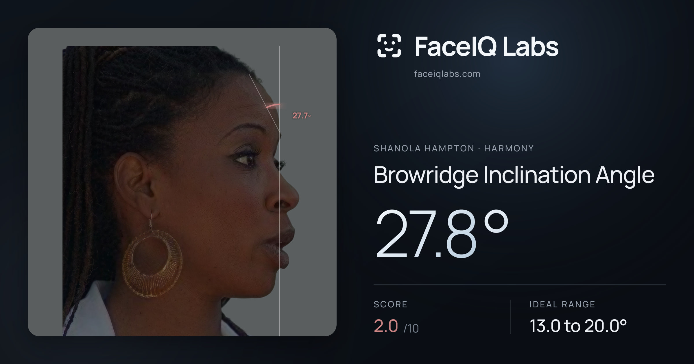 Shanola Hampton Browridge Inclination Angle: 27.8°, drawn on the photo