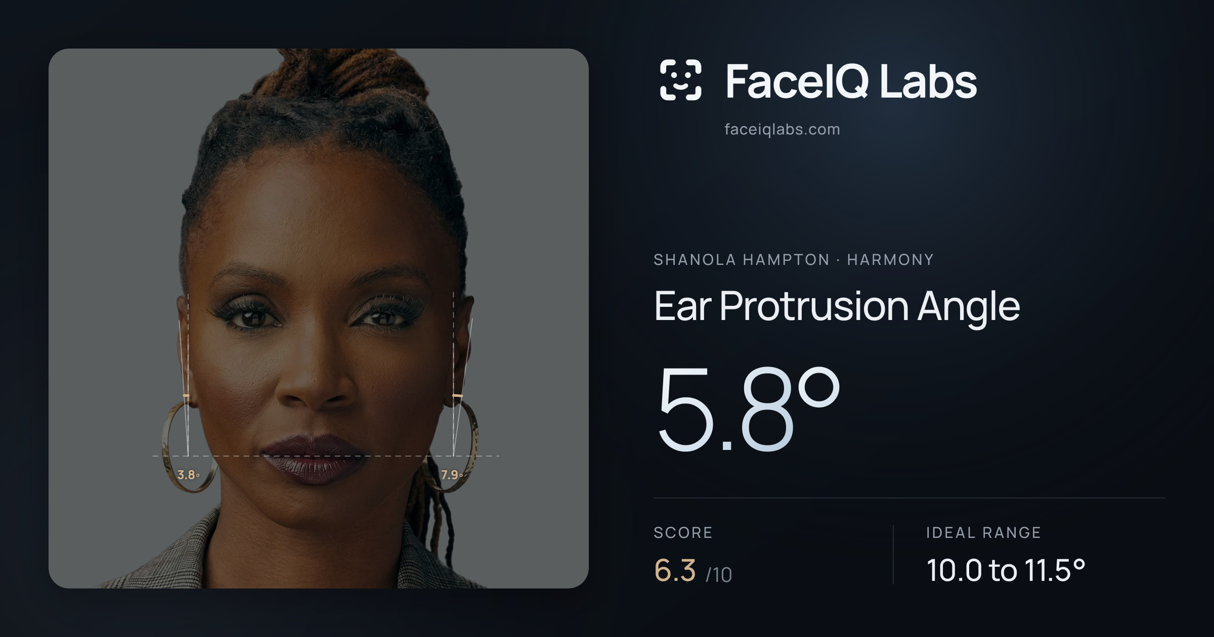 Shanola Hampton Ear Protrusion Angle: 5.8°, drawn on the photo