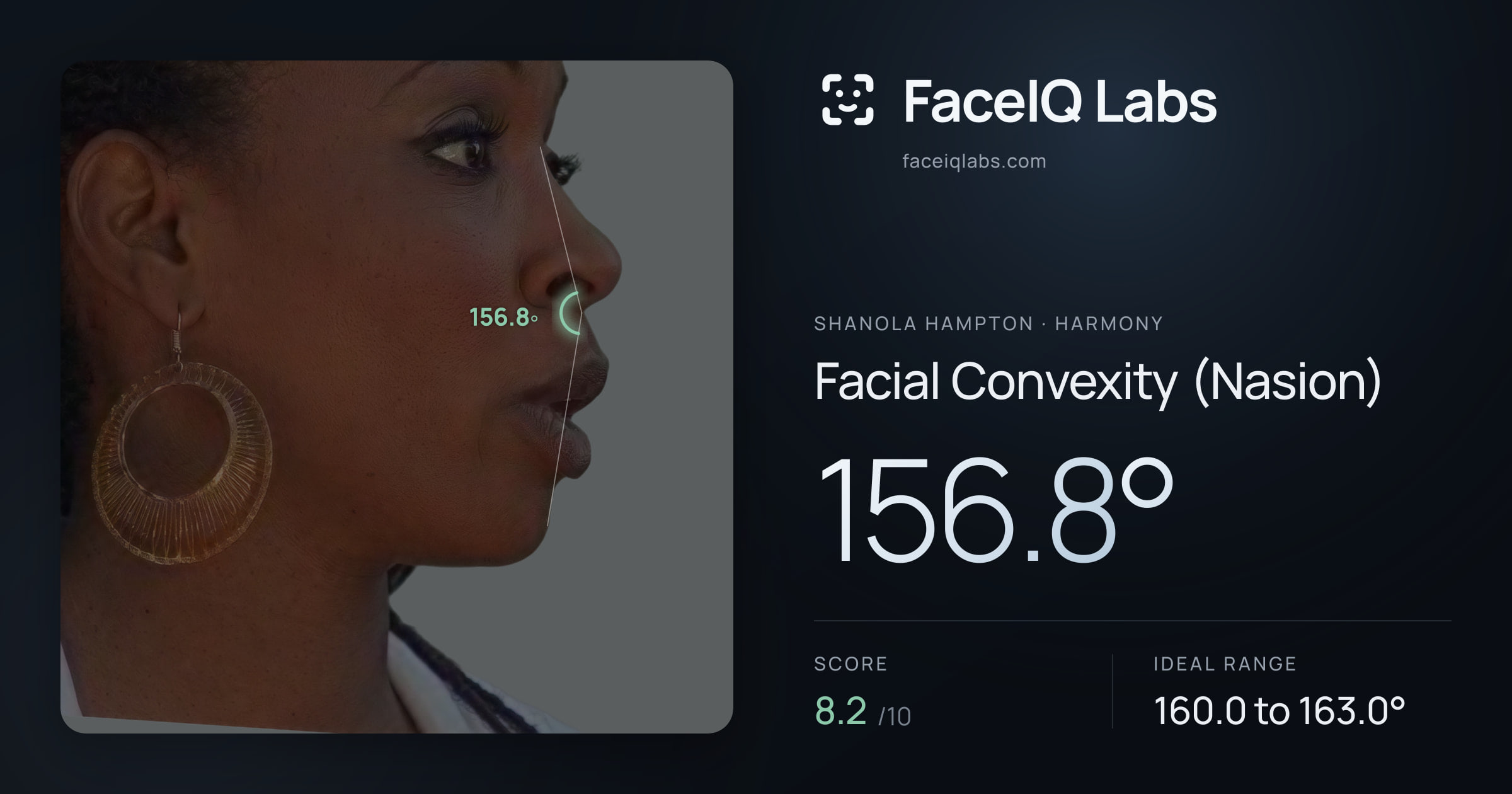 Shanola Hampton Facial Convexity (Nasion): 156.8°, drawn on the photo