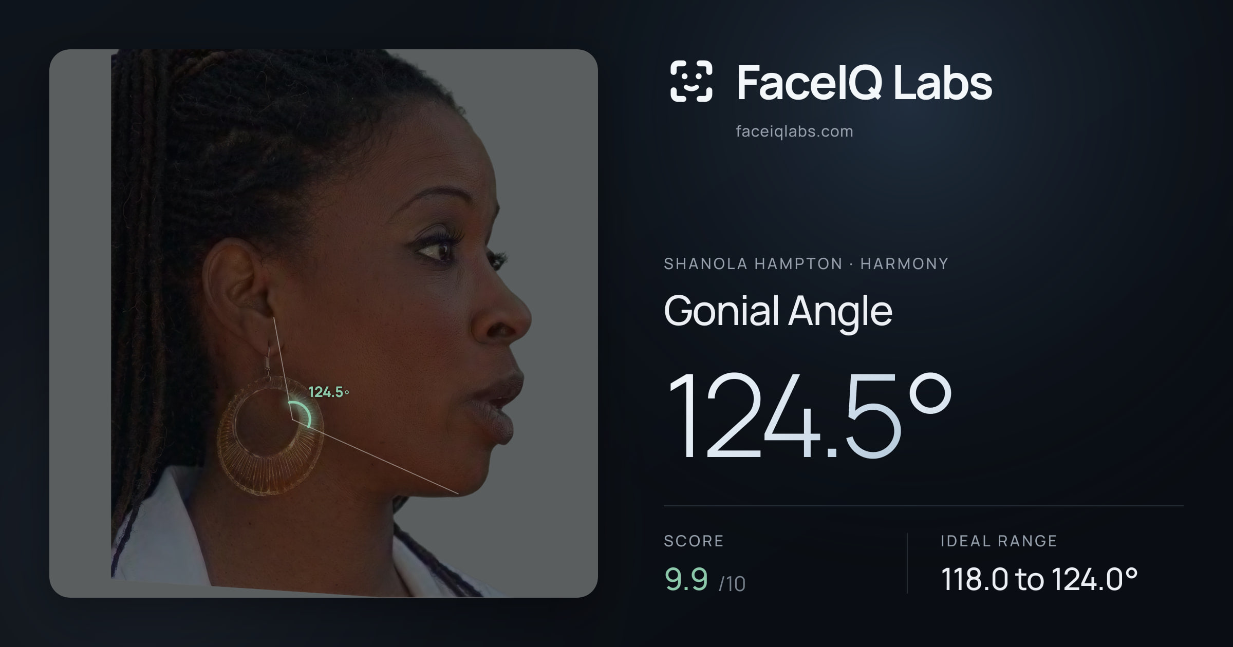 Shanola Hampton Gonial Angle: 124.5°, drawn on the photo