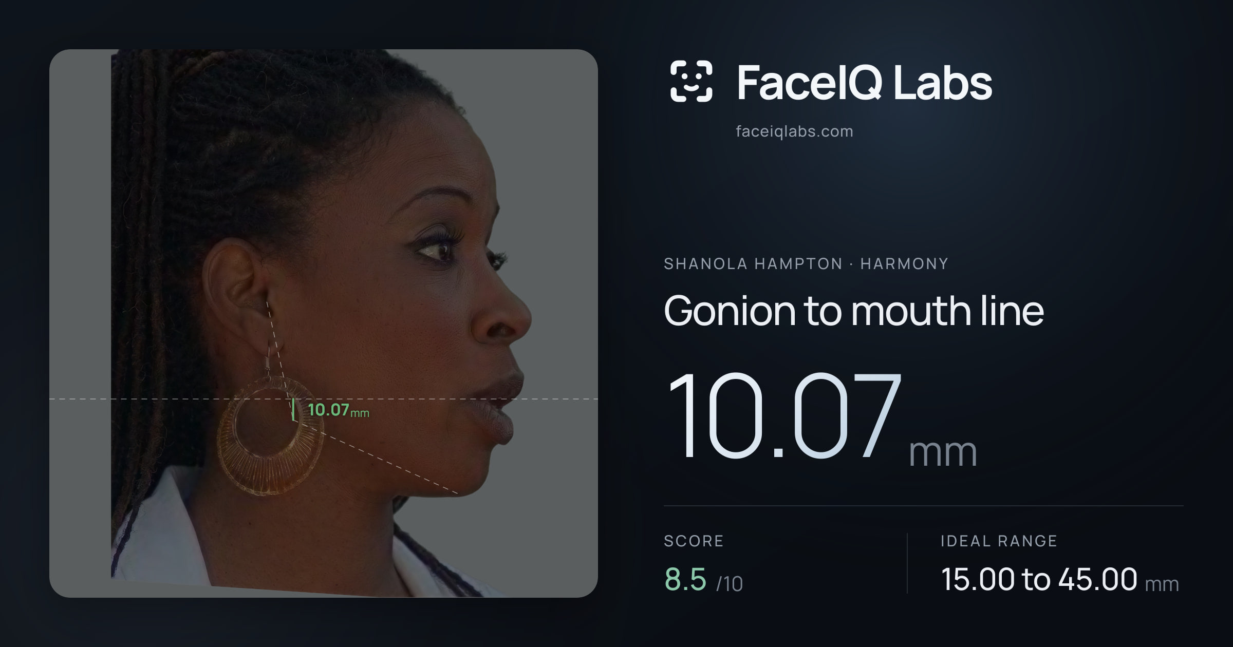 Shanola Hampton Gonion to mouth line: 10.07mm, drawn on the photo