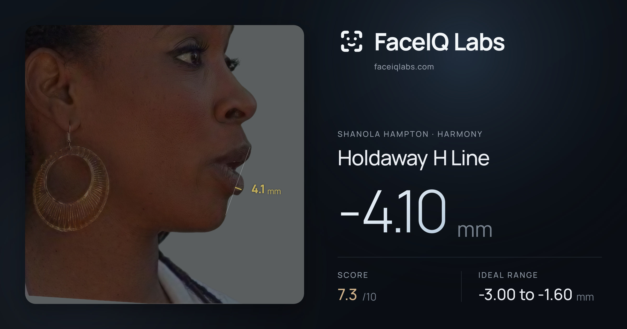 Shanola Hampton Holdaway H Line: -4.10mm, drawn on the photo