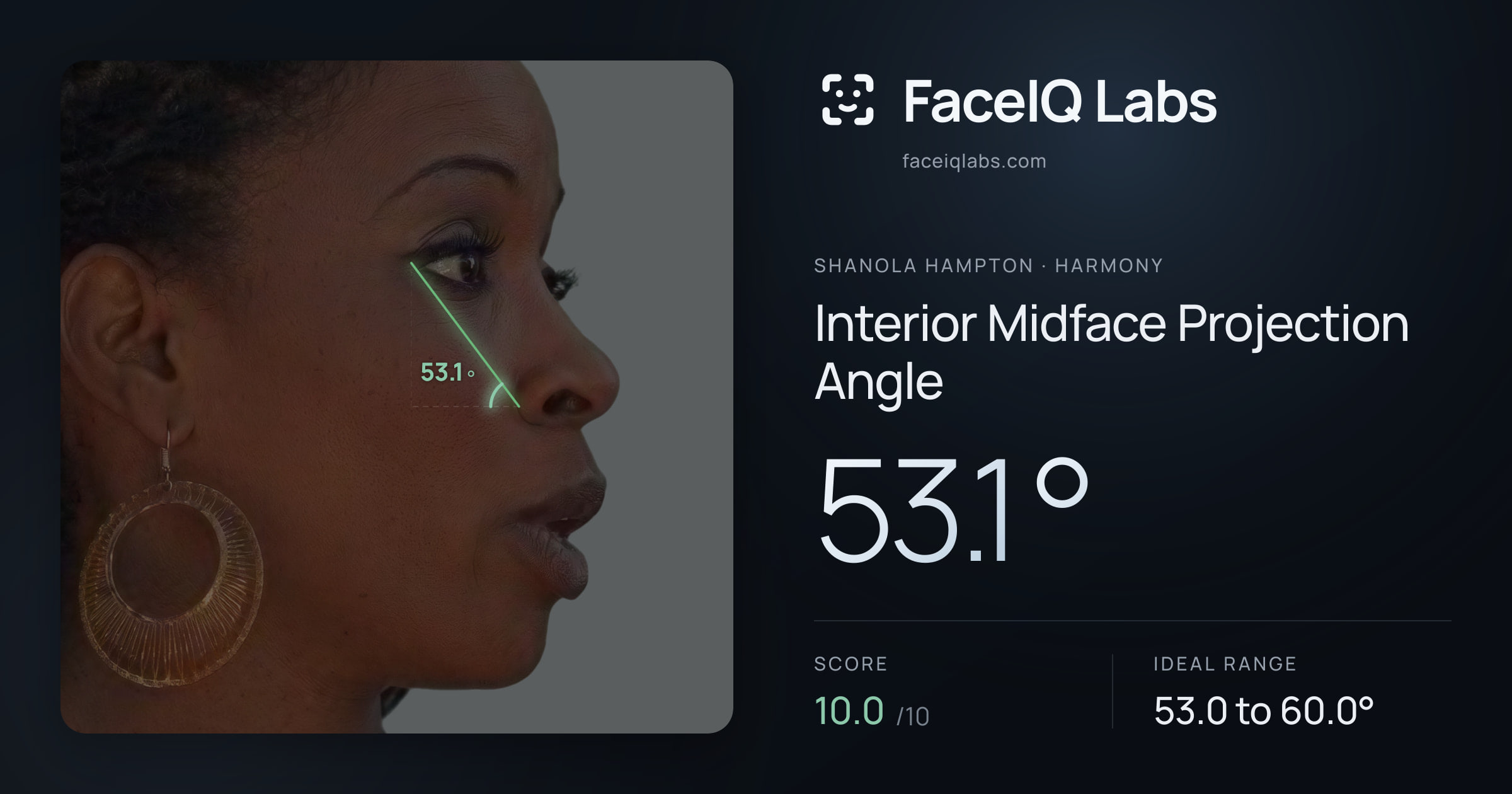 Shanola Hampton Interior Midface Projection Angle: 53.1°, drawn on the photo