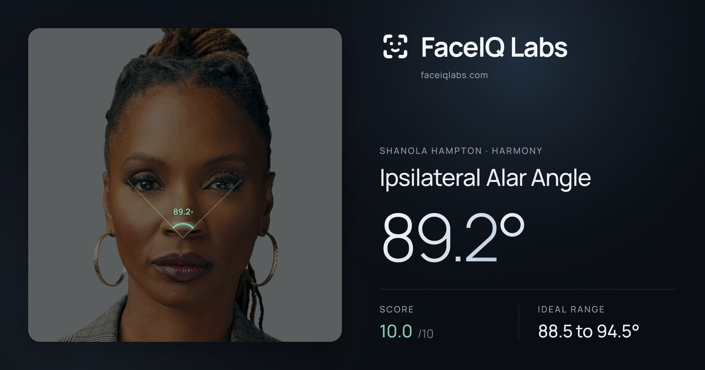 Shanola Hampton Ipsilateral Alar Angle: 89.2°, drawn on the photo