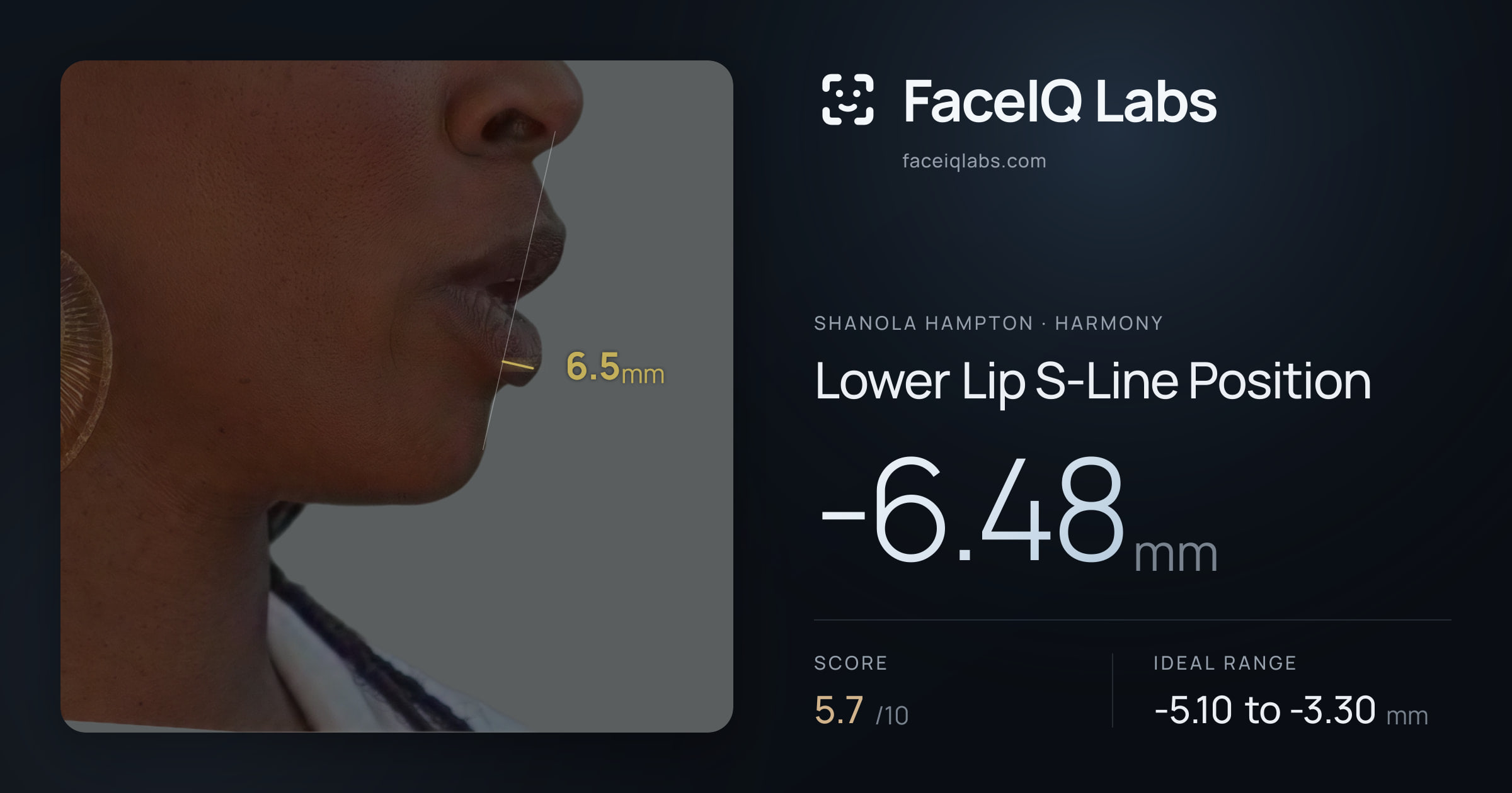 Shanola Hampton Lower Lip S-Line Position: -6.48mm, drawn on the photo