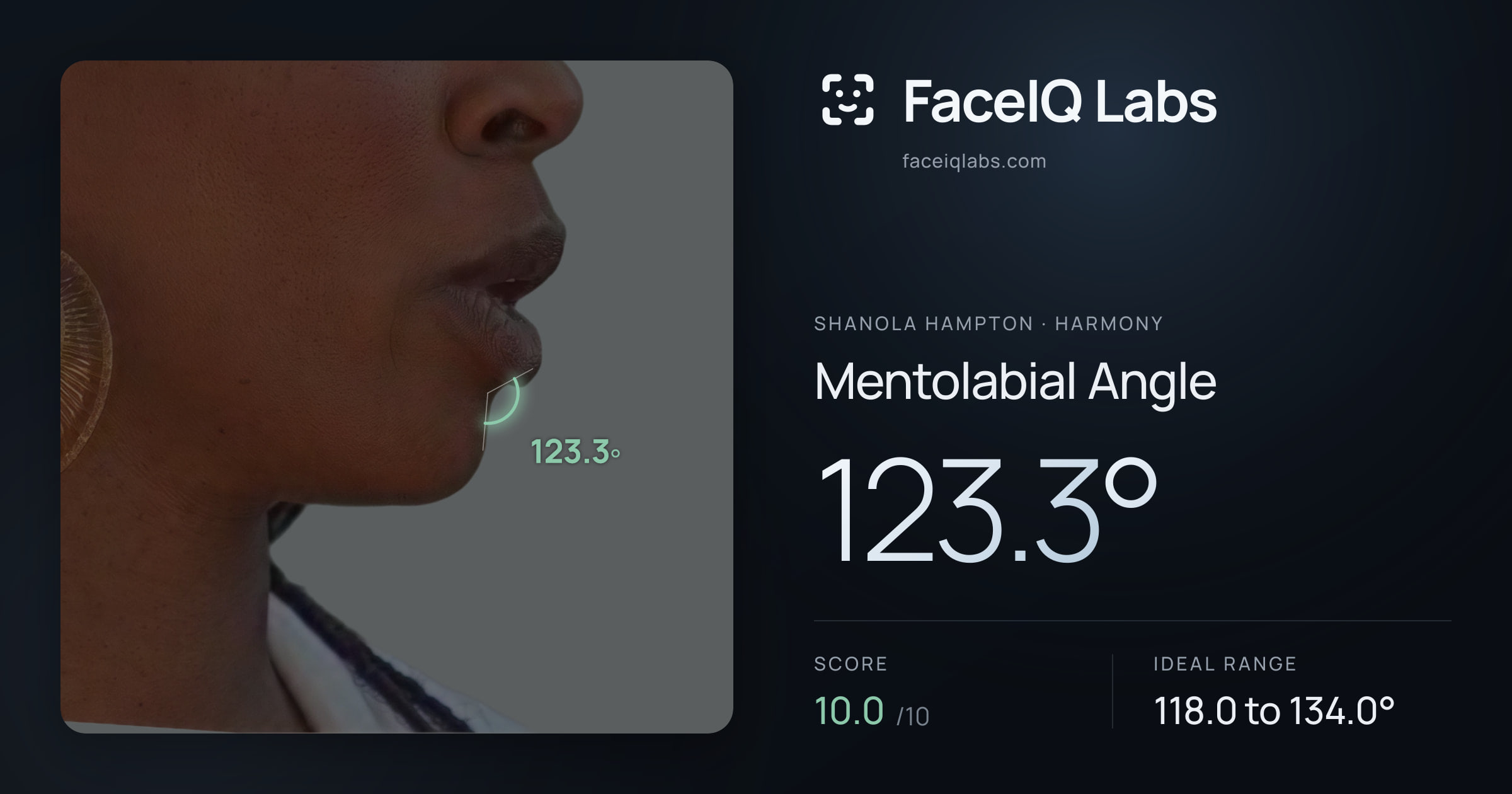 Shanola Hampton Mentolabial Angle: 123.3°, drawn on the photo