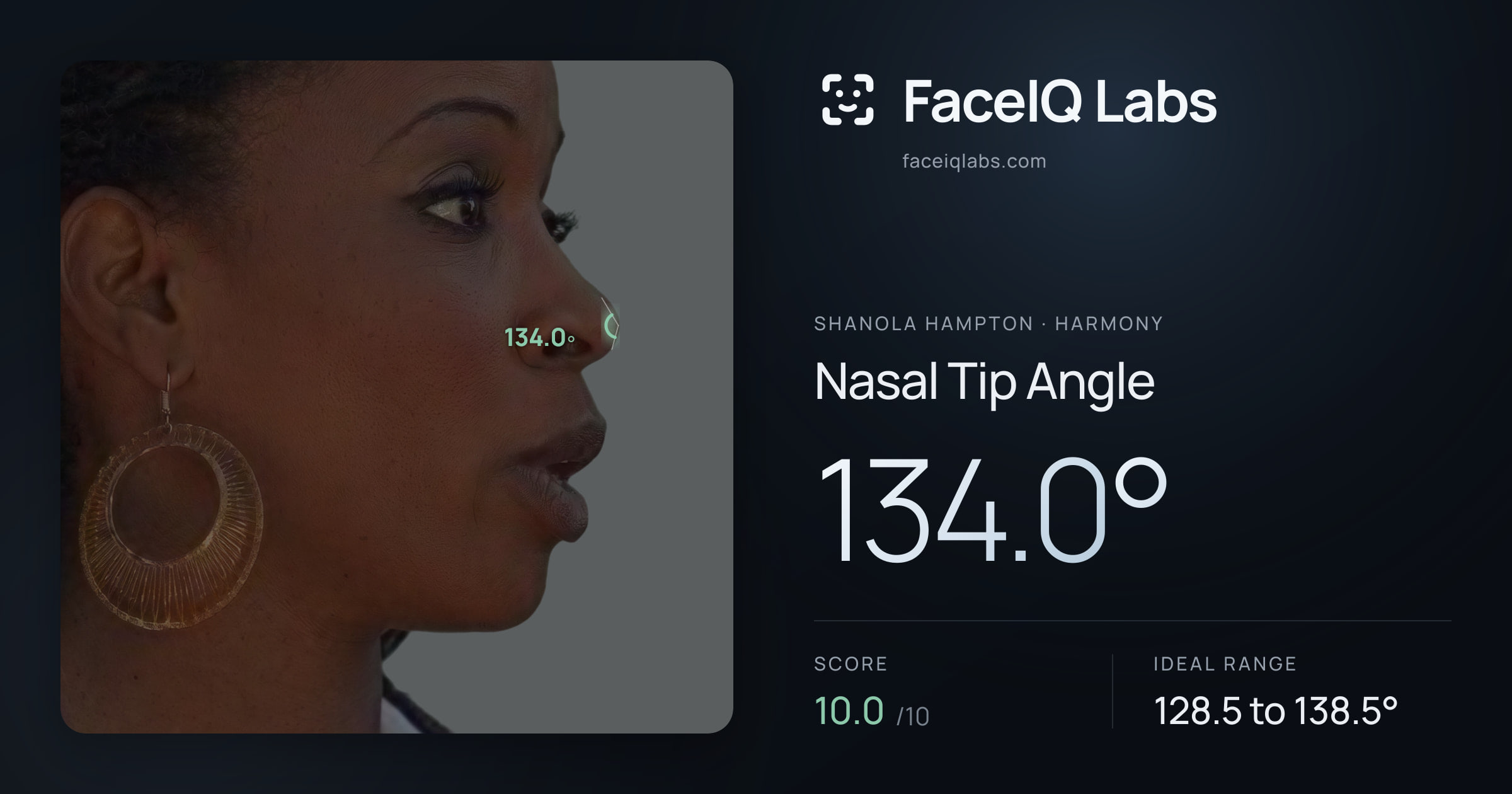 Shanola Hampton Nasal Tip Angle: 134.0°, drawn on the photo