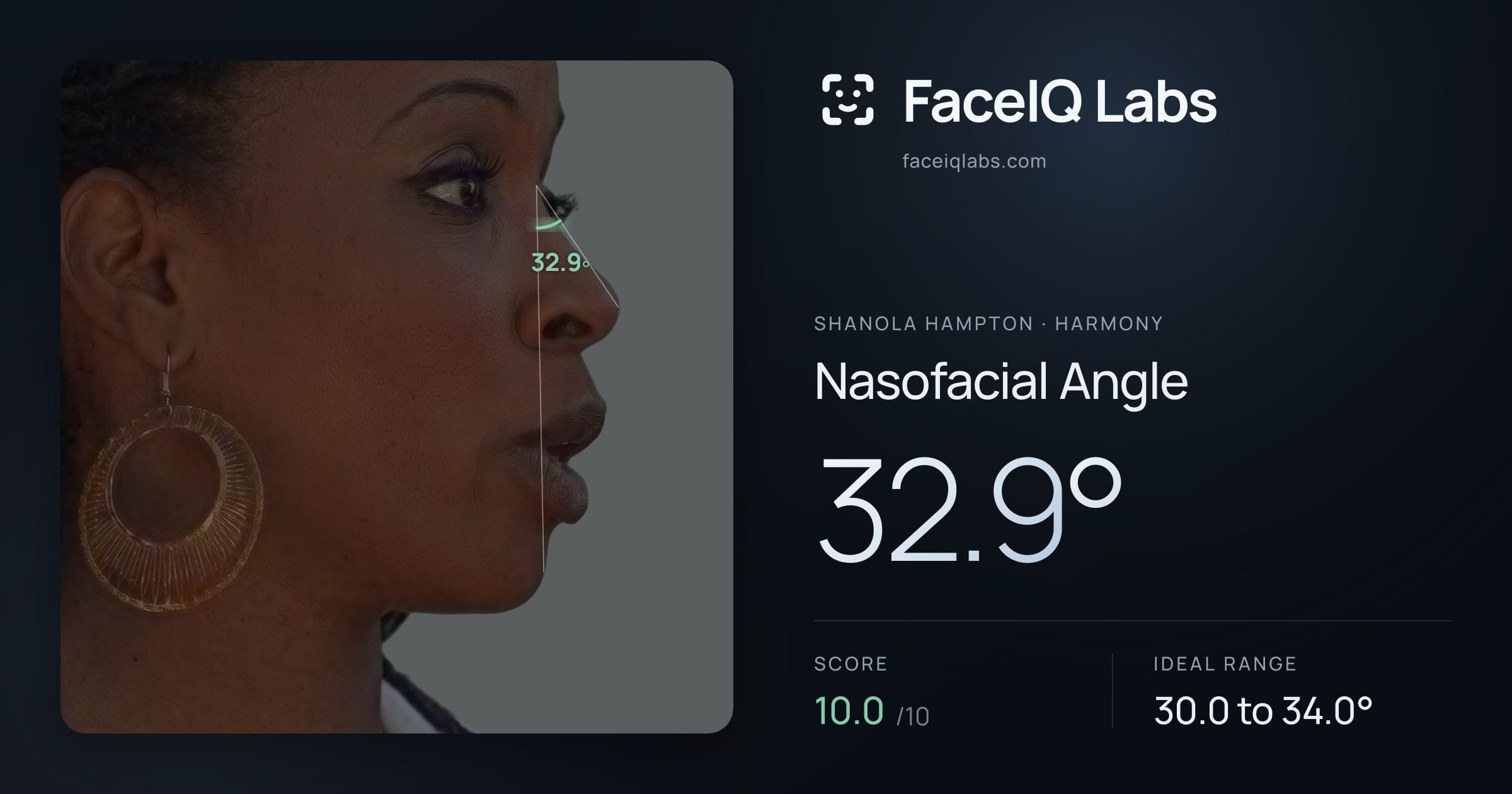 Shanola Hampton Nasofacial Angle: 32.9°, drawn on the photo
