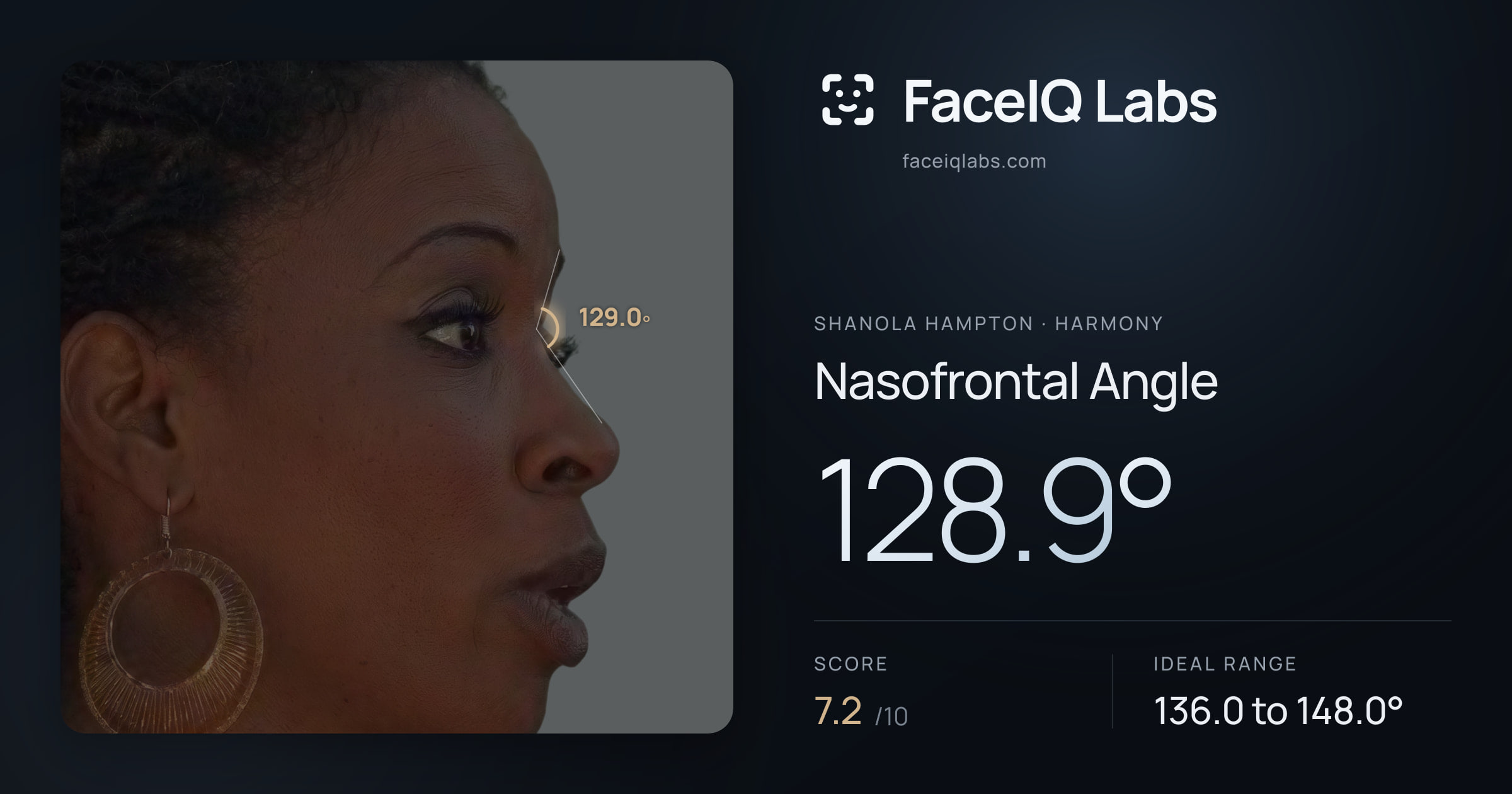 Shanola Hampton Nasofrontal Angle: 128.9°, drawn on the photo