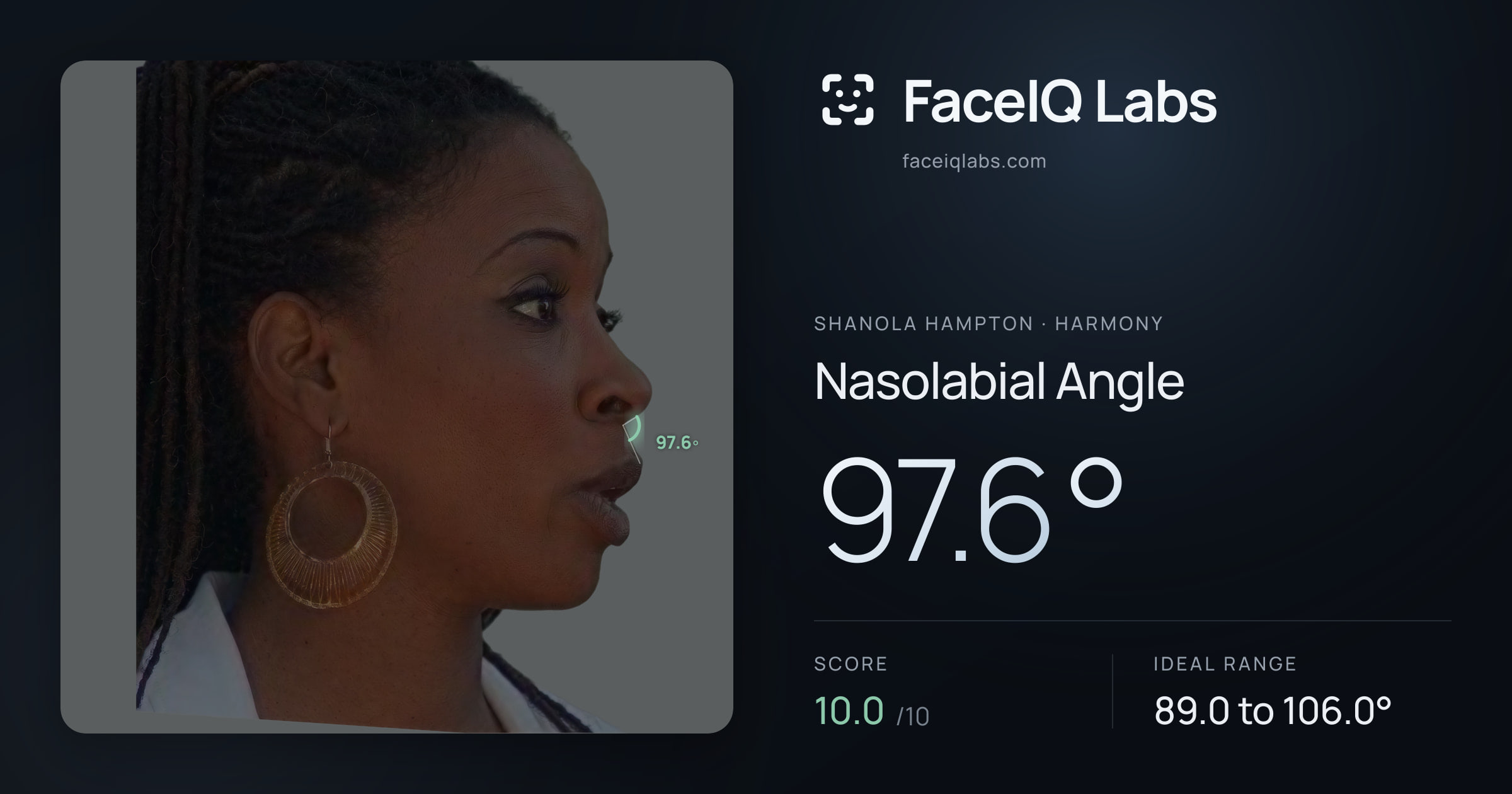 Shanola Hampton Nasolabial Angle: 97.6°, drawn on the photo