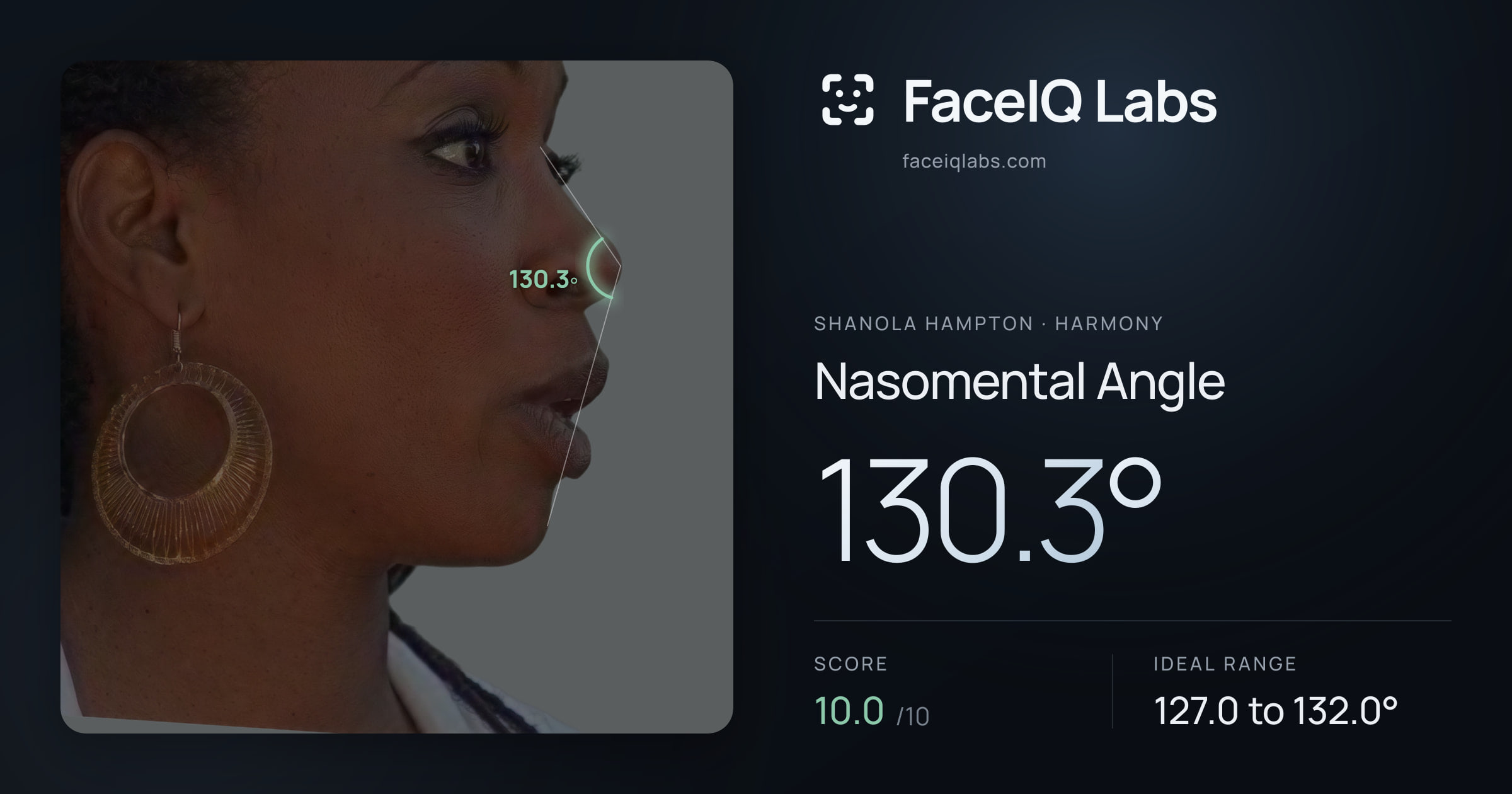Shanola Hampton Nasomental Angle: 130.3°, drawn on the photo