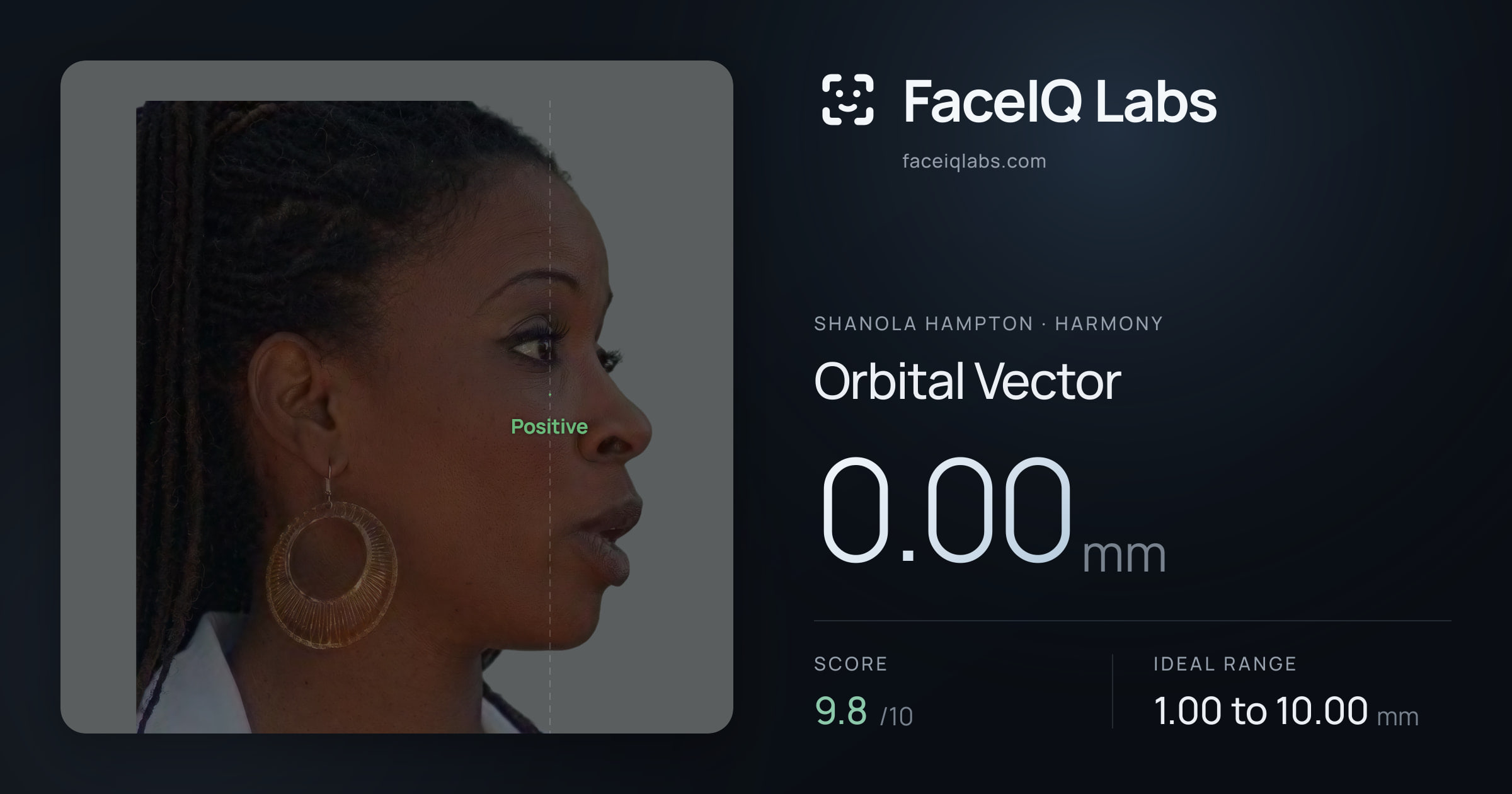 Shanola Hampton Orbital Vector: 0.00mm, drawn on the photo
