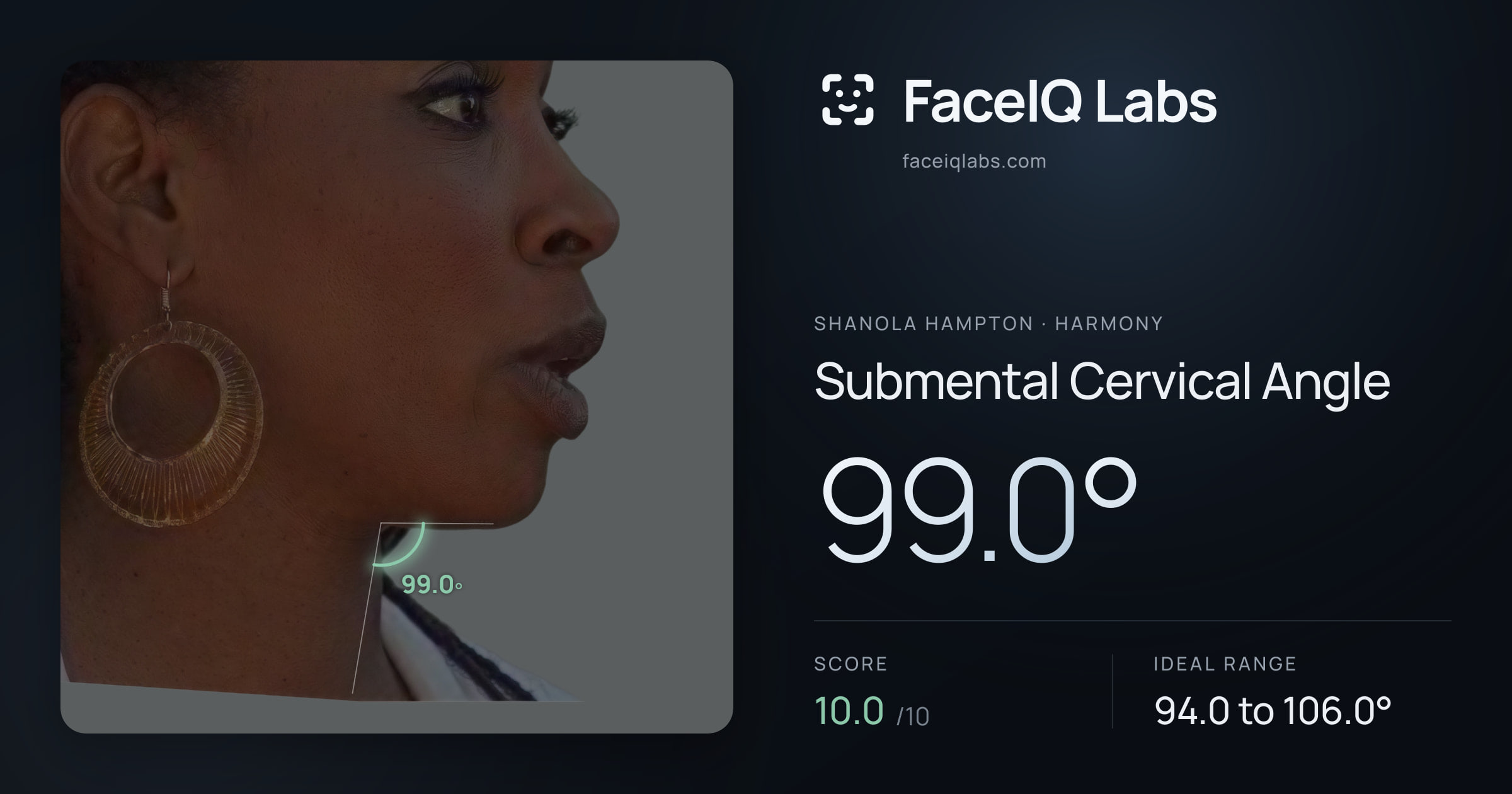 Shanola Hampton Submental Cervical Angle: 99.0°, drawn on the photo