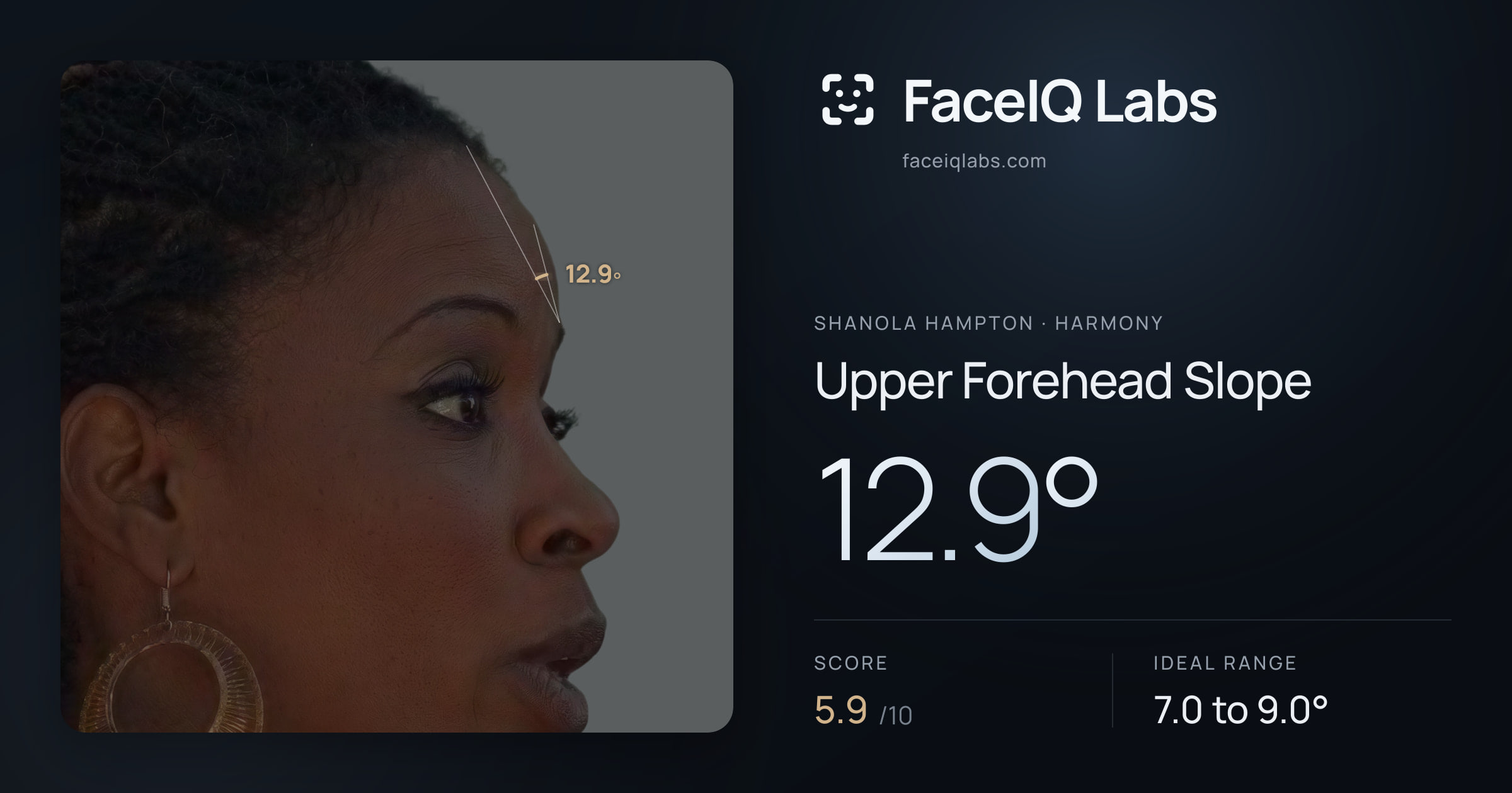 Shanola Hampton Upper Forehead Slope: 12.9°, drawn on the photo