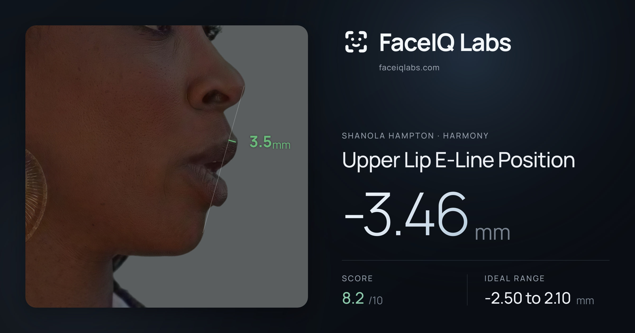 Shanola Hampton Upper Lip E-Line Position: -3.46mm, drawn on the photo