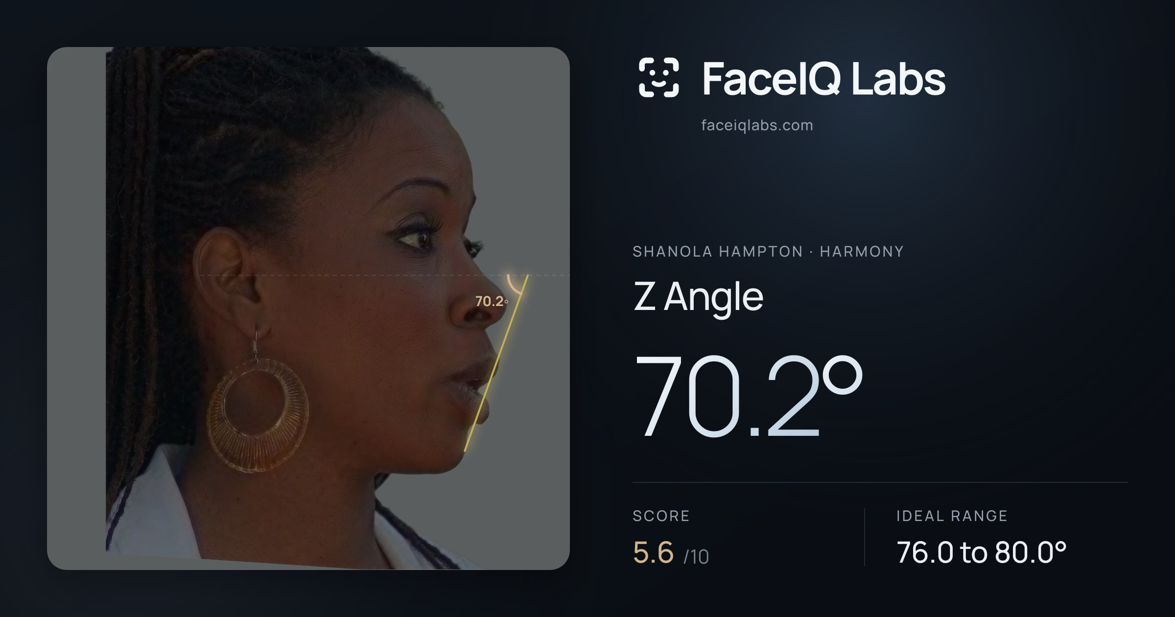 Shanola Hampton Z Angle: 70.2°, drawn on the photo
